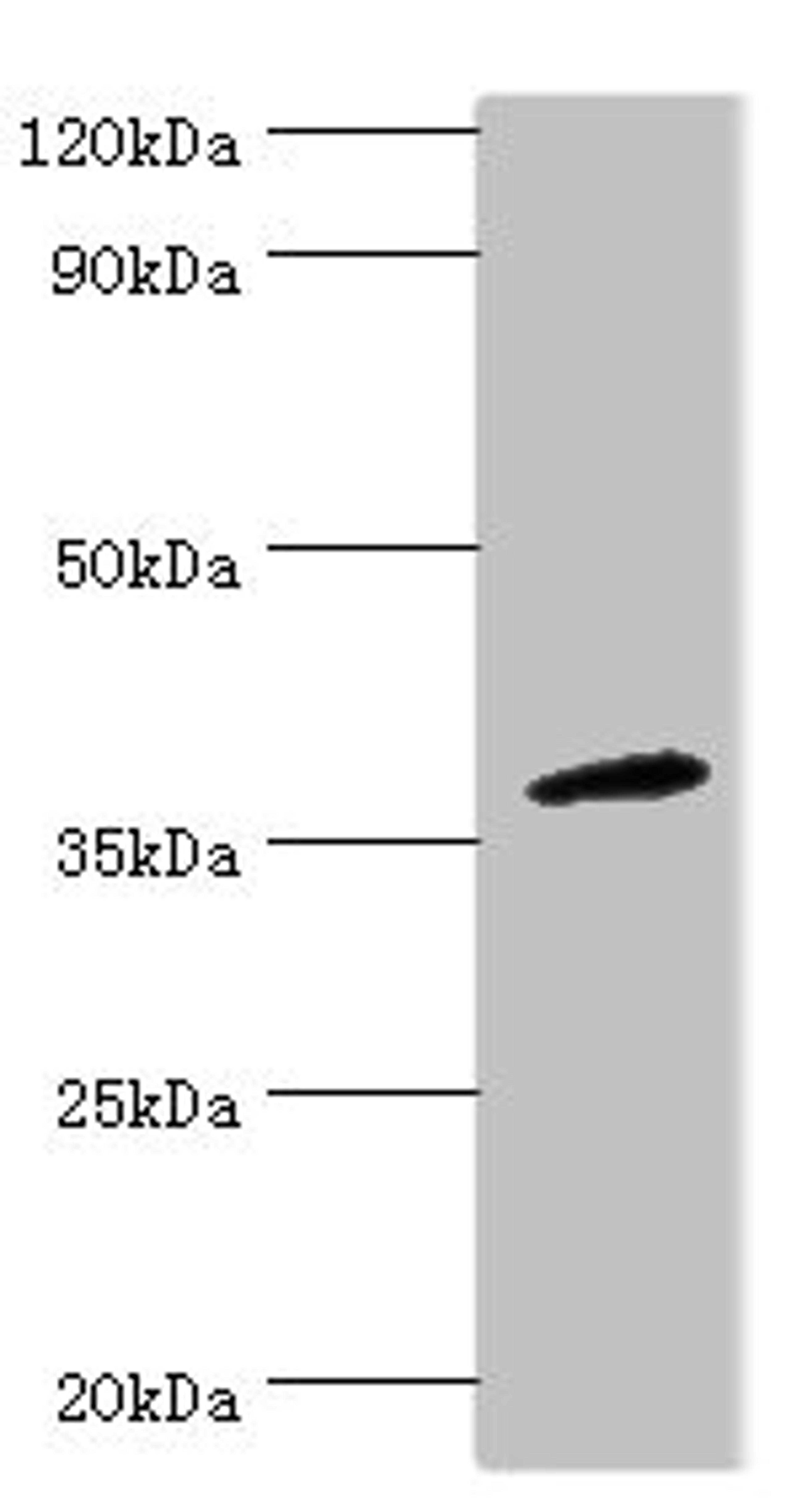 Western blot. All lanes: CD200R1 antibody at 4ug/ml + Mouse lung tissue. Secondary. Goat polyclonal to rabbit IgG at 1/10000 dilution. Predicted band size: 37, 22, 19, 40 kDa. Observed band size: 37 kDa.