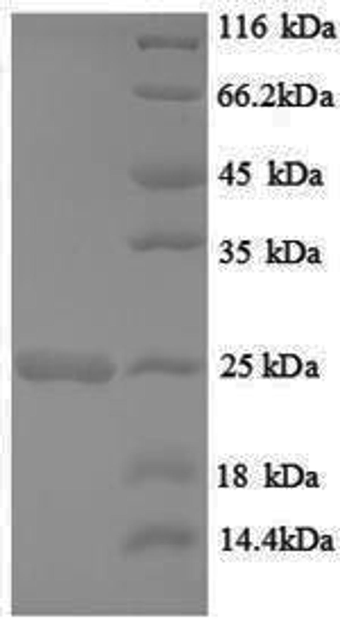 (Tris-Glycine gel) Discontinuous SDS-PAGE (reduced) with 5% enrichment gel and 15% separation gel.