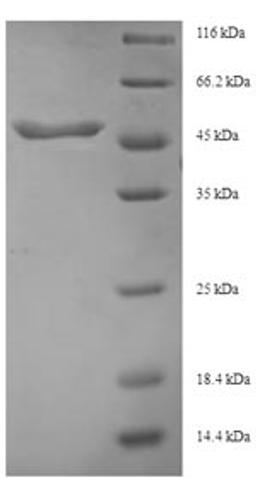 (Tris-Glycine gel) Discontinuous SDS-PAGE (reduced) with 5% enrichment gel and 15% separation gel.