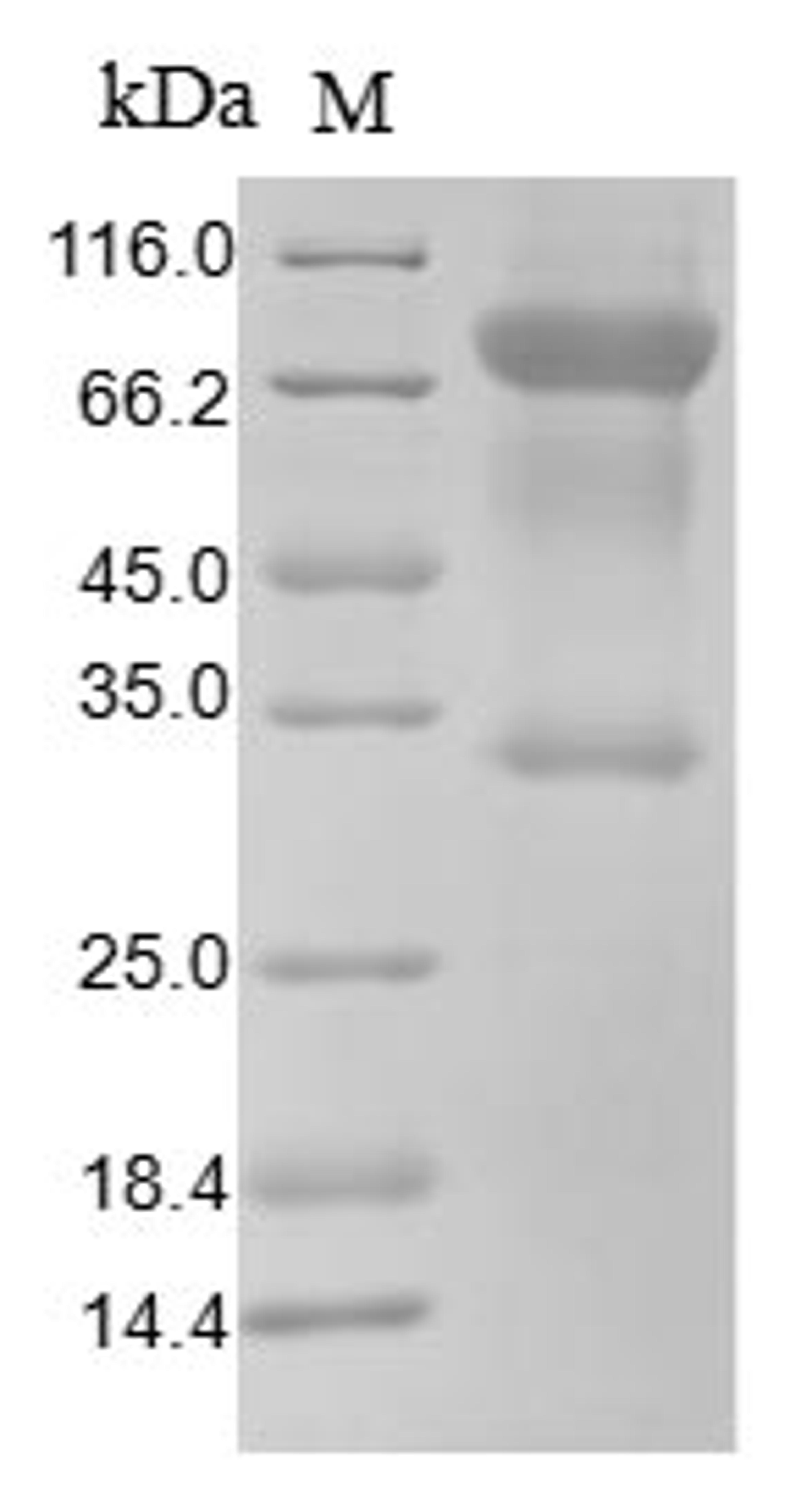 (Tris-Glycine gel) Discontinuous SDS-PAGE (reduced) with 5% enrichment gel and 15% separation gel.