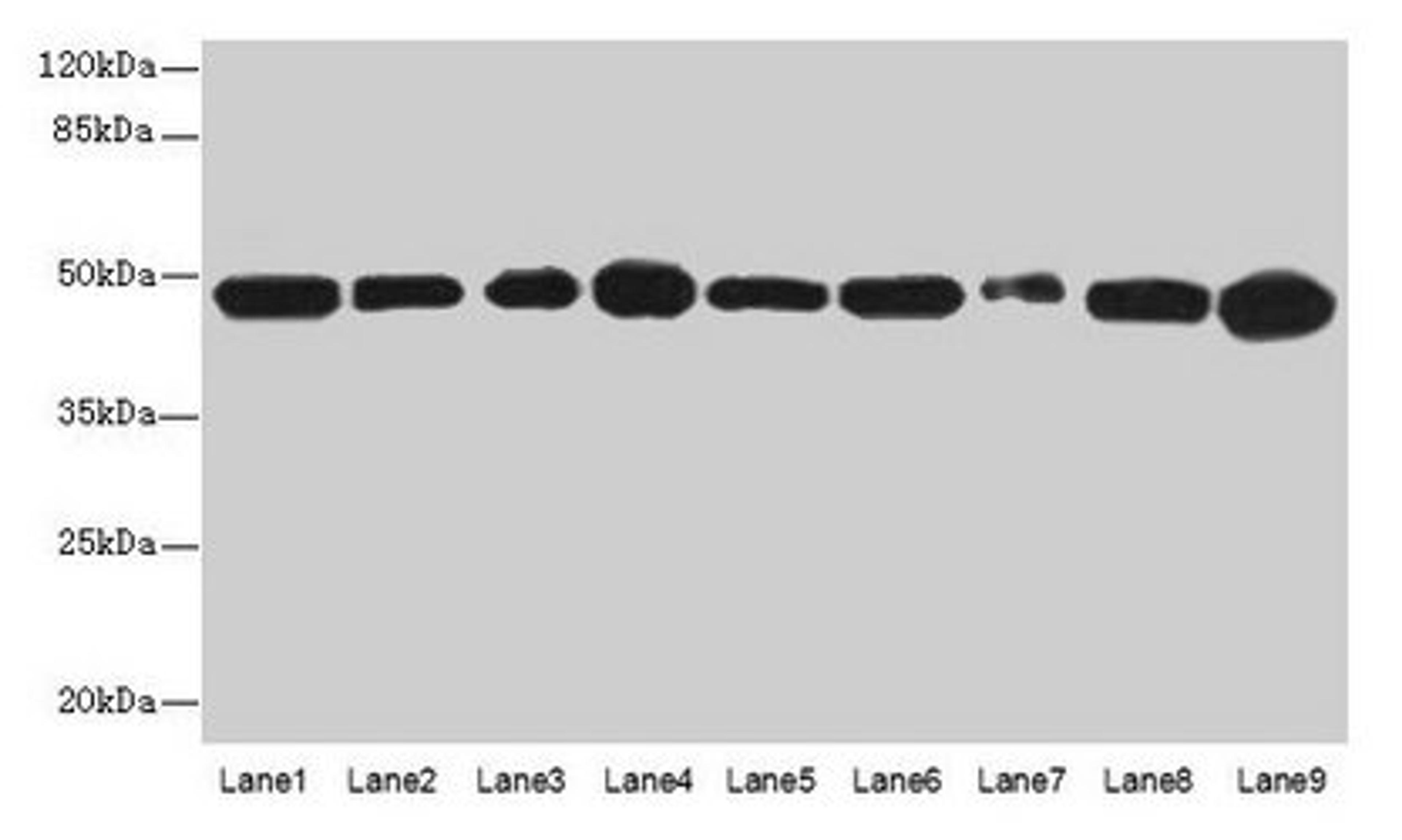 Western blot. All lanes: GOT2 antibody at 3µg/ml. Lane 1: A431 whole cell lysate. Lane 2: HepG2 whole cell lysate. Lane 3: Mouse muscle tissue . Lane 4: Mouse spleen tissue. Lane 5: MCF-7 whole cell lysate. Lane 6: Hela whole cell lysate. Lane 7: LO2 whole cell lysate. Lane 8: 293T whole cell lysate. Lane 9: HL60 whole cell lysate. Secondary. Goat polyclonal to rabbit IgG at 1/10000 dilution. Predicted band size: 48, 44 kDa. Observed band size: 48 kDa