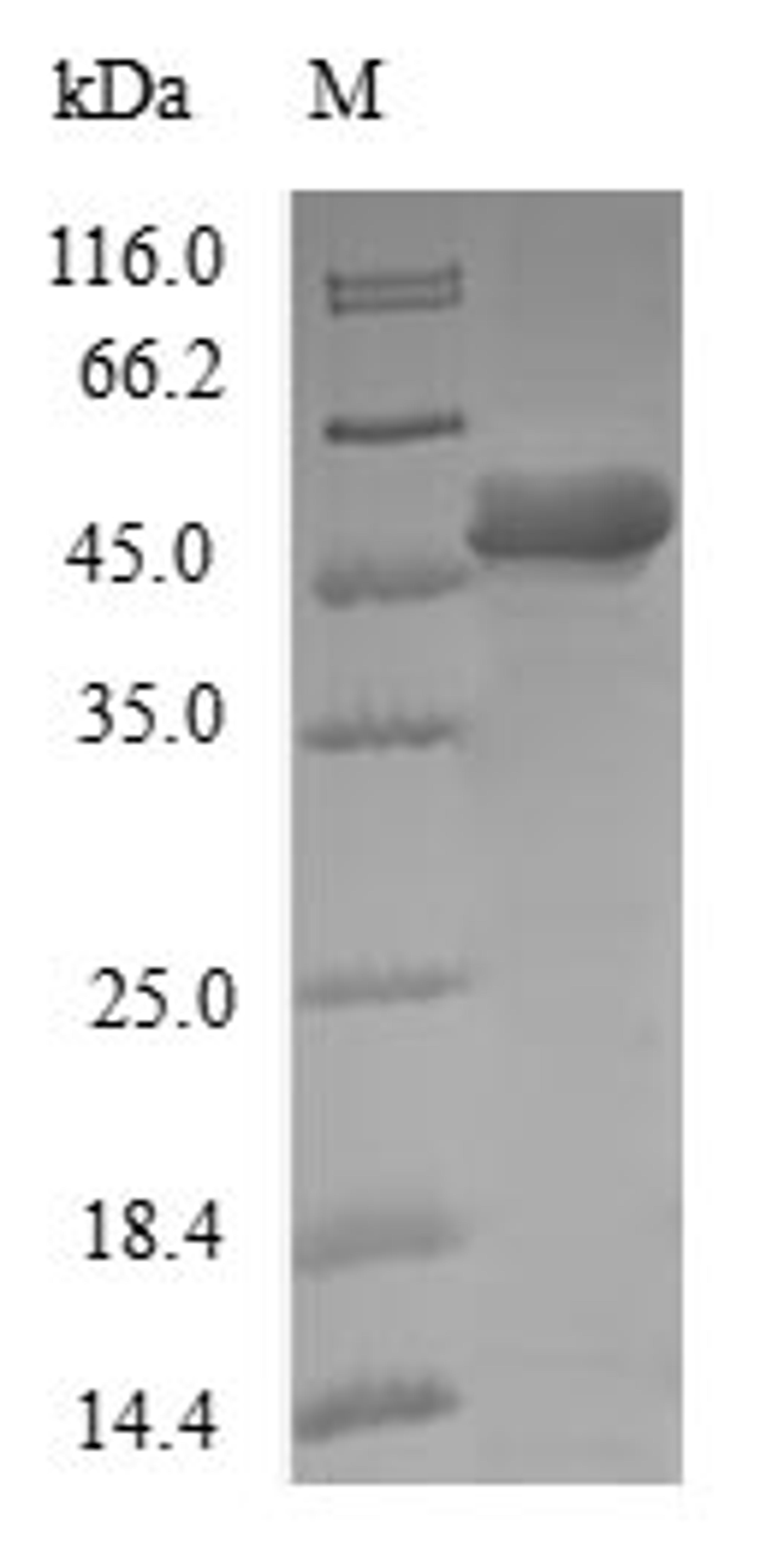 (Tris-Glycine gel) Discontinuous SDS-PAGE (reduced) with 5% enrichment gel and 15% separation gel.