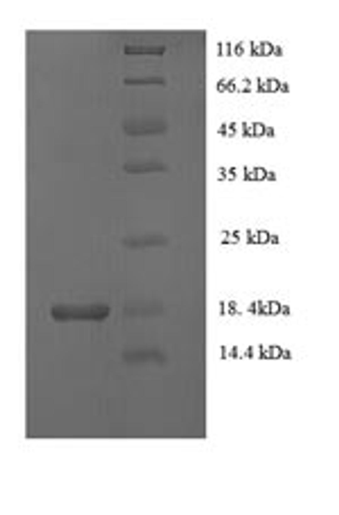 (Tris-Glycine gel) Discontinuous SDS-PAGE (reduced) with 5% enrichment gel and 15% separation gel.