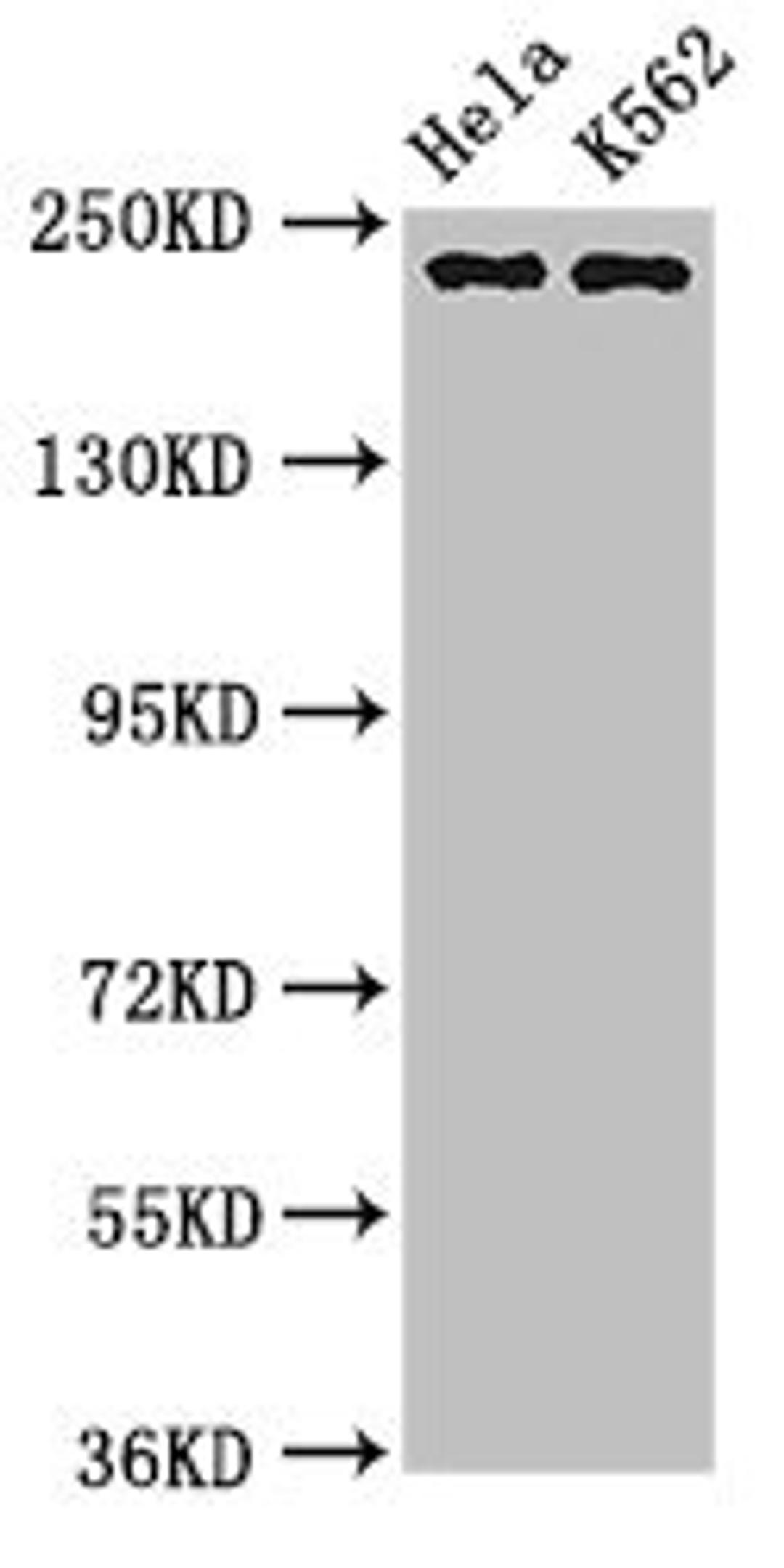 Western Blot. Positive WB detected in: Hela whole cell lysate, K562 whole cell lysate. All lanes: NUMA1 antibody at 3.2µg/ml. Secondary. Goat polyclonal to rabbit IgG at 1/50000 dilution. Predicted band size: 239, 237, 202, 201, 110 kDa. Observed band size: 239 kDa