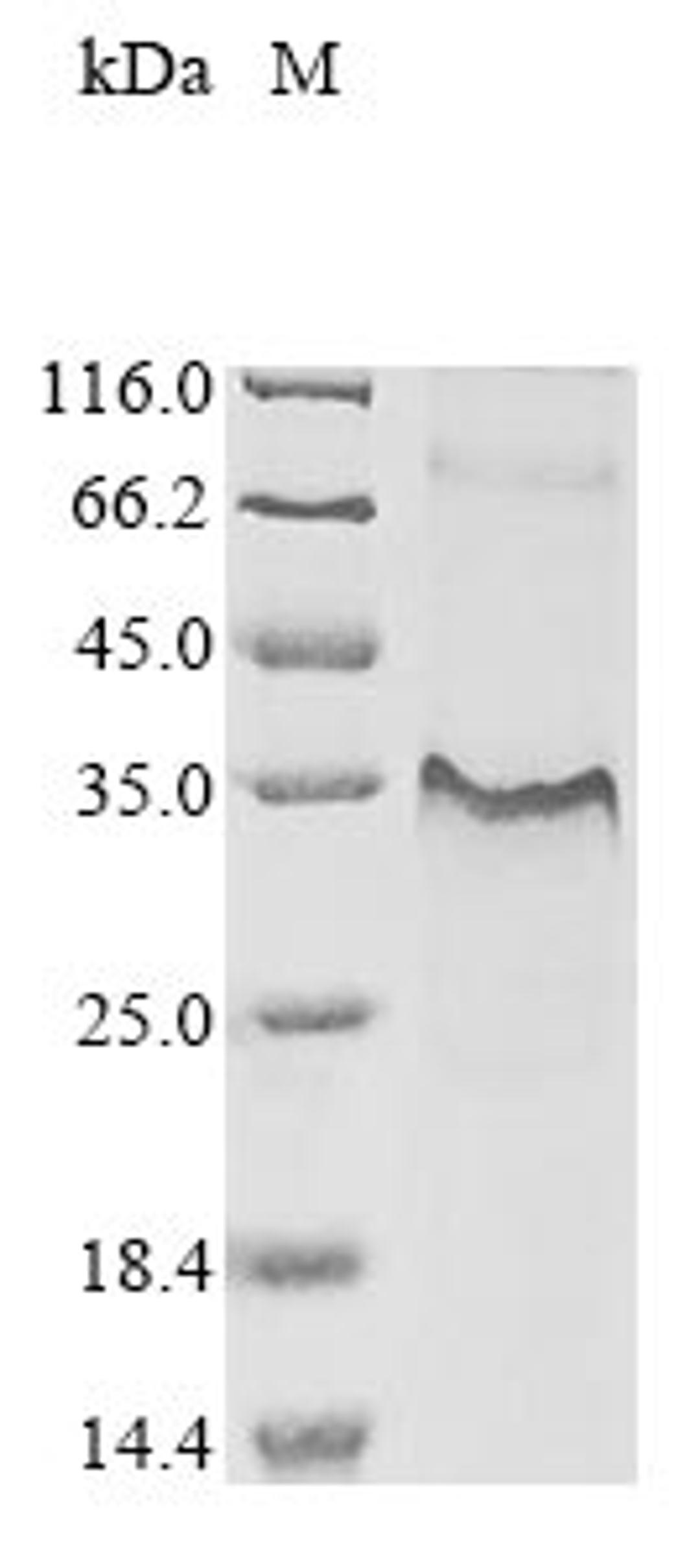 (Tris-Glycine gel) Discontinuous SDS-PAGE (reduced) with 5% enrichment gel and 15% separation gel.