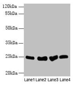 Western blot. All lanes: Socs3 antibody at 12µg/ml. Lane 1: K562 whole cell lysate. Lane 2: A375 whole cell lysate. Lane 3: Hela whole cell lysate. Lane 4: HepG2 whole cell lysate. Secondary. Goat polyclonal to rabbit IgG at 1/10000 dilution. Predicted band size: 25 kDa. Observed band size: 25 kDa