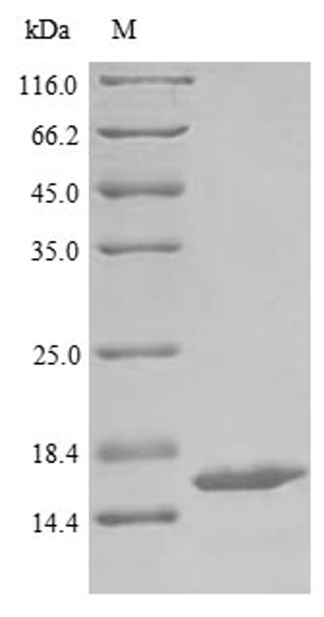 (Tris-Glycine gel) Discontinuous SDS-PAGE (reduced) with 5% enrichment gel and 15% separation gel.