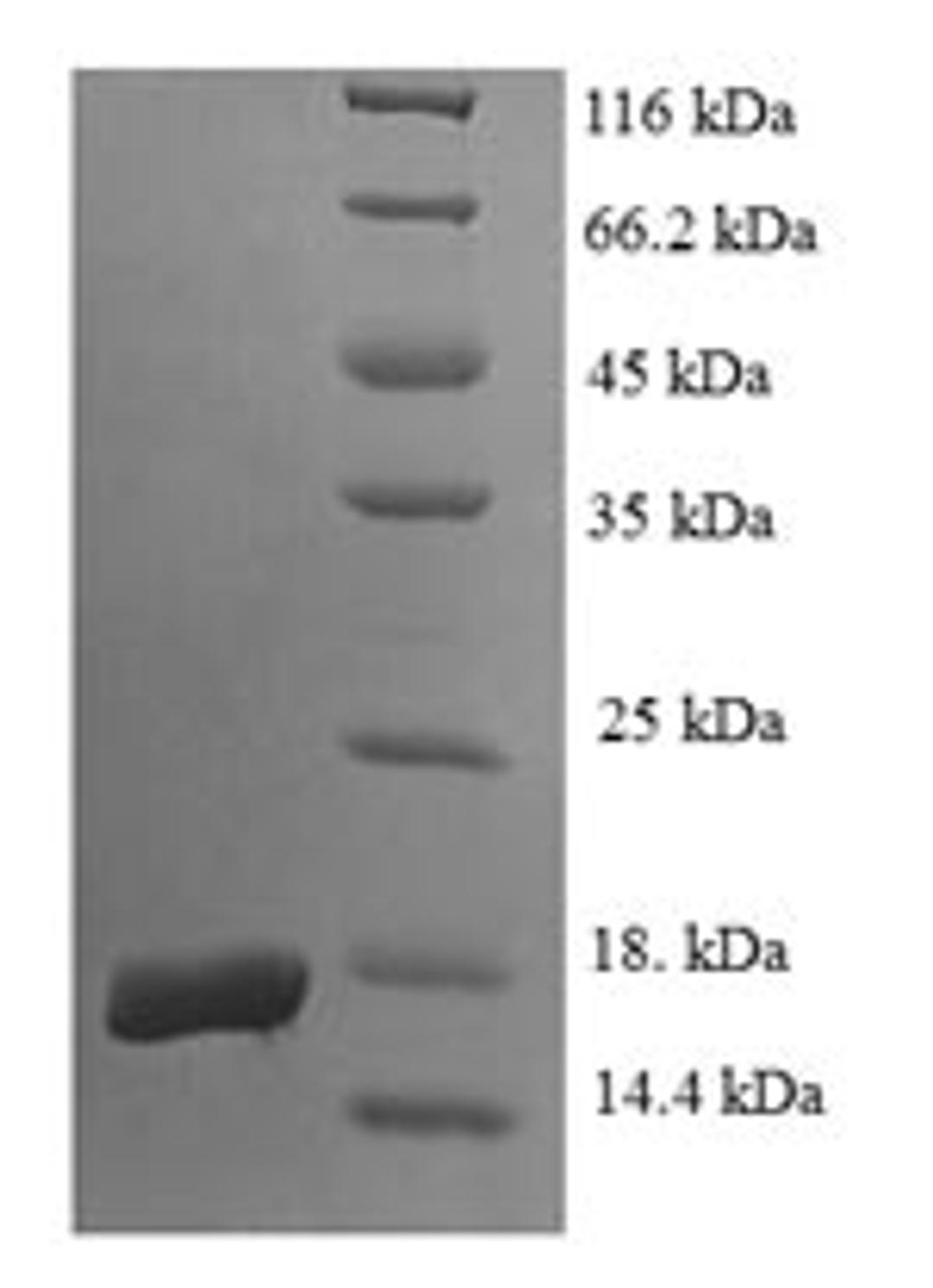 (Tris-Glycine gel) Discontinuous SDS-PAGE (reduced) with 5% enrichment gel and 15% separation gel.