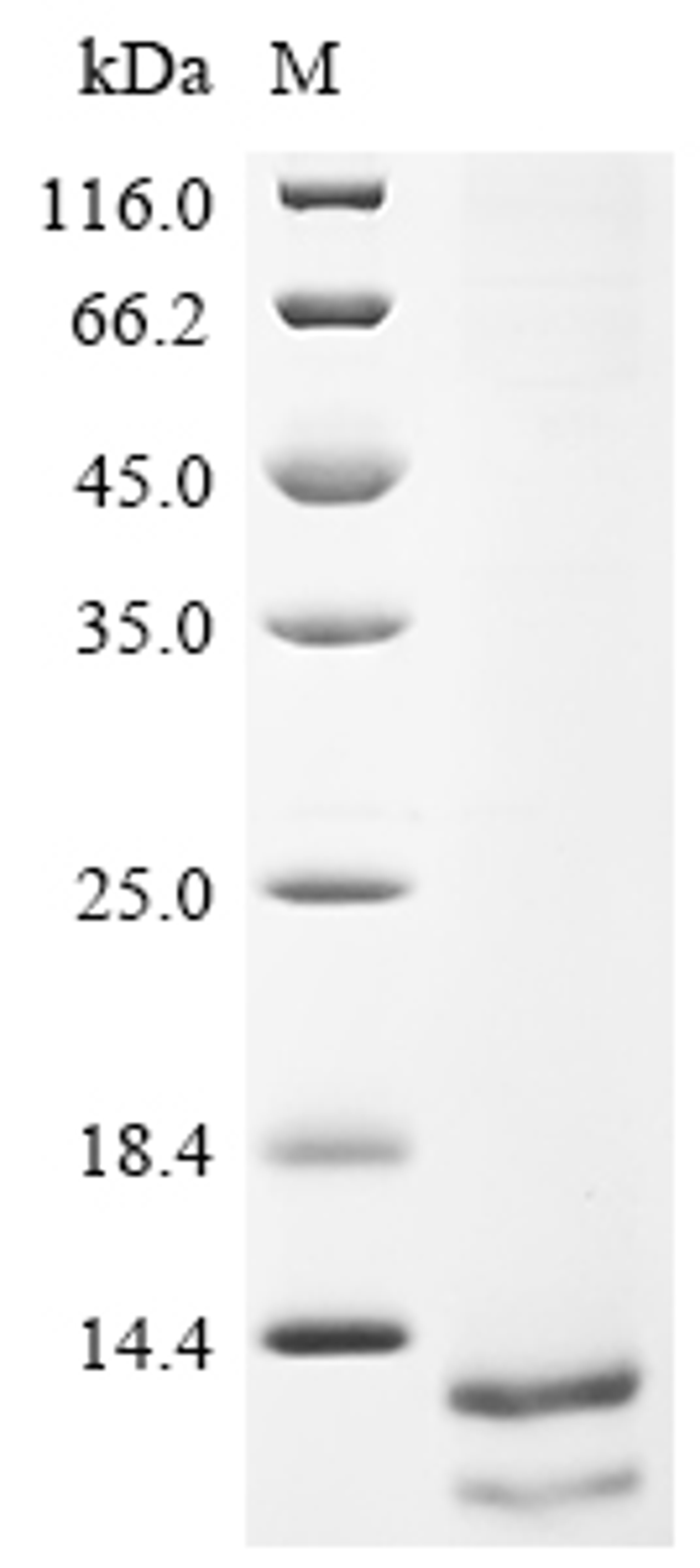 (Tris-Glycine gel) Discontinuous SDS-PAGE (reduced) with 5% enrichment gel and 15% separation gel.