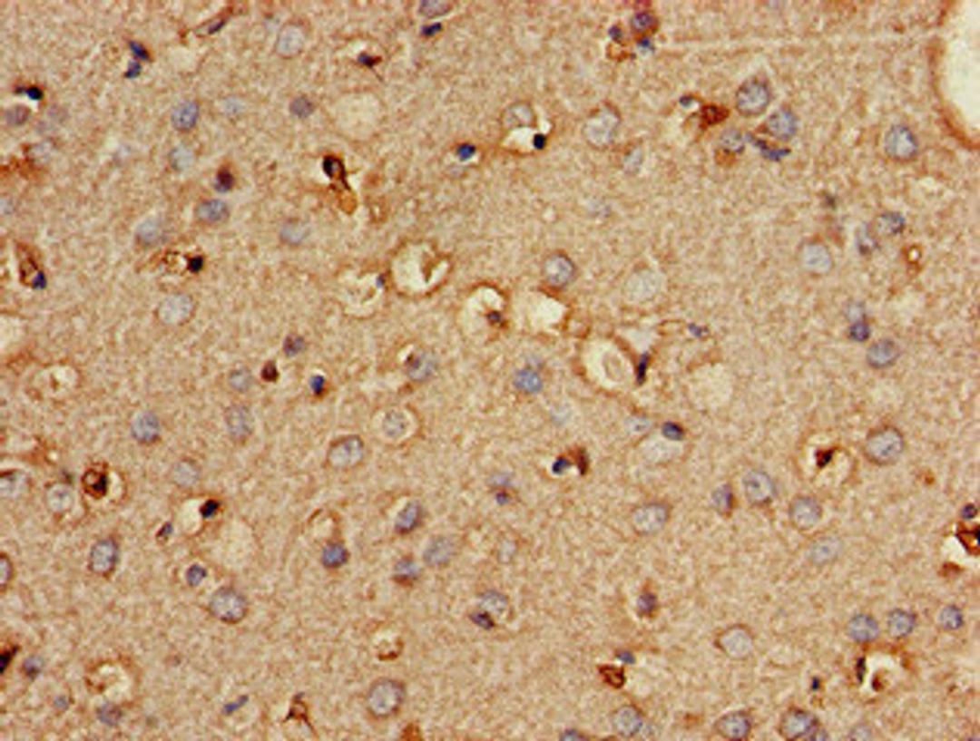 Immunohistochemistry of paraffin-embedded human brain tissue using CSB-PA018146LA01HU at dilution of 1:100