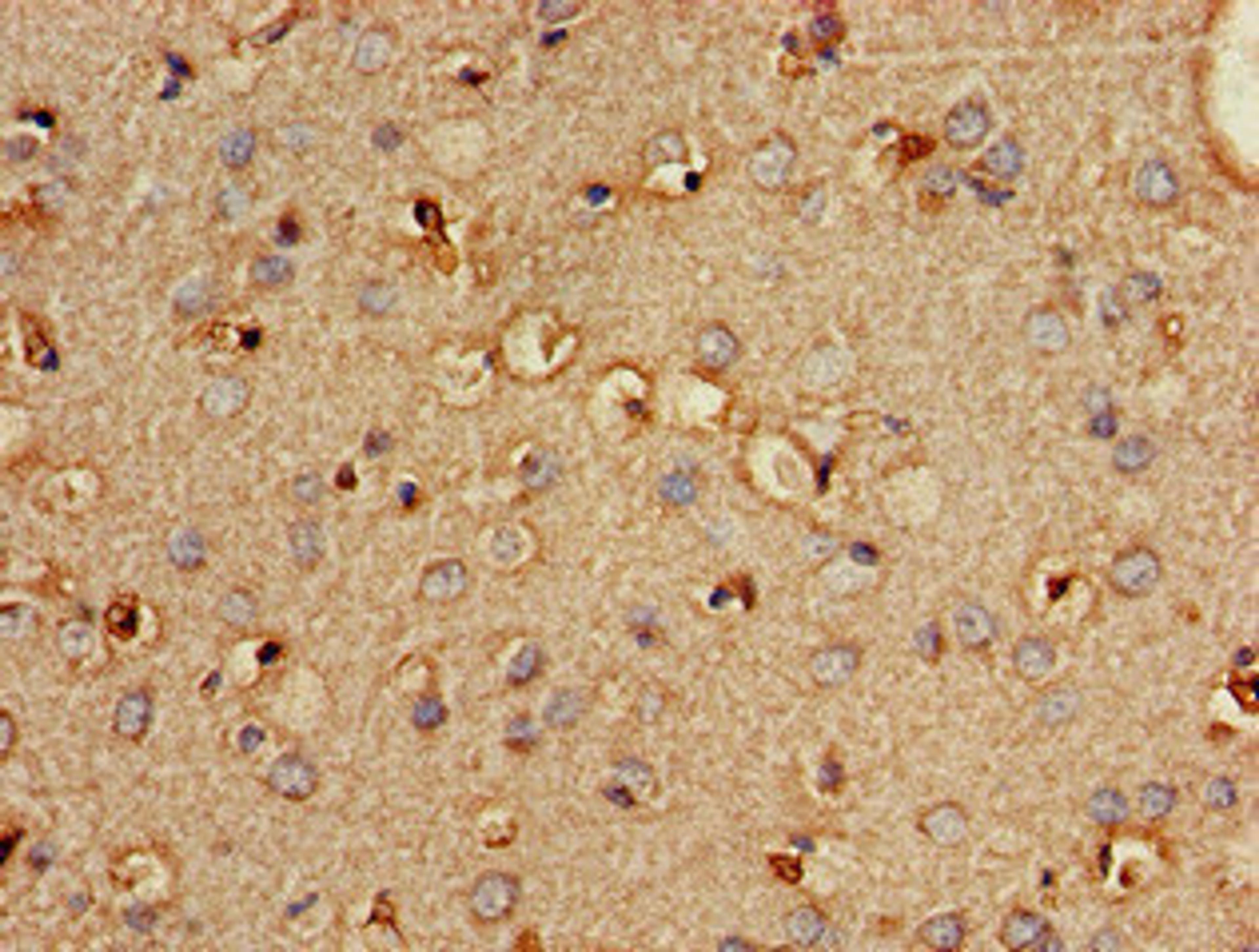 Immunohistochemistry of paraffin-embedded human brain tissue using CSB-PA018146LA01HU at dilution of 1:100