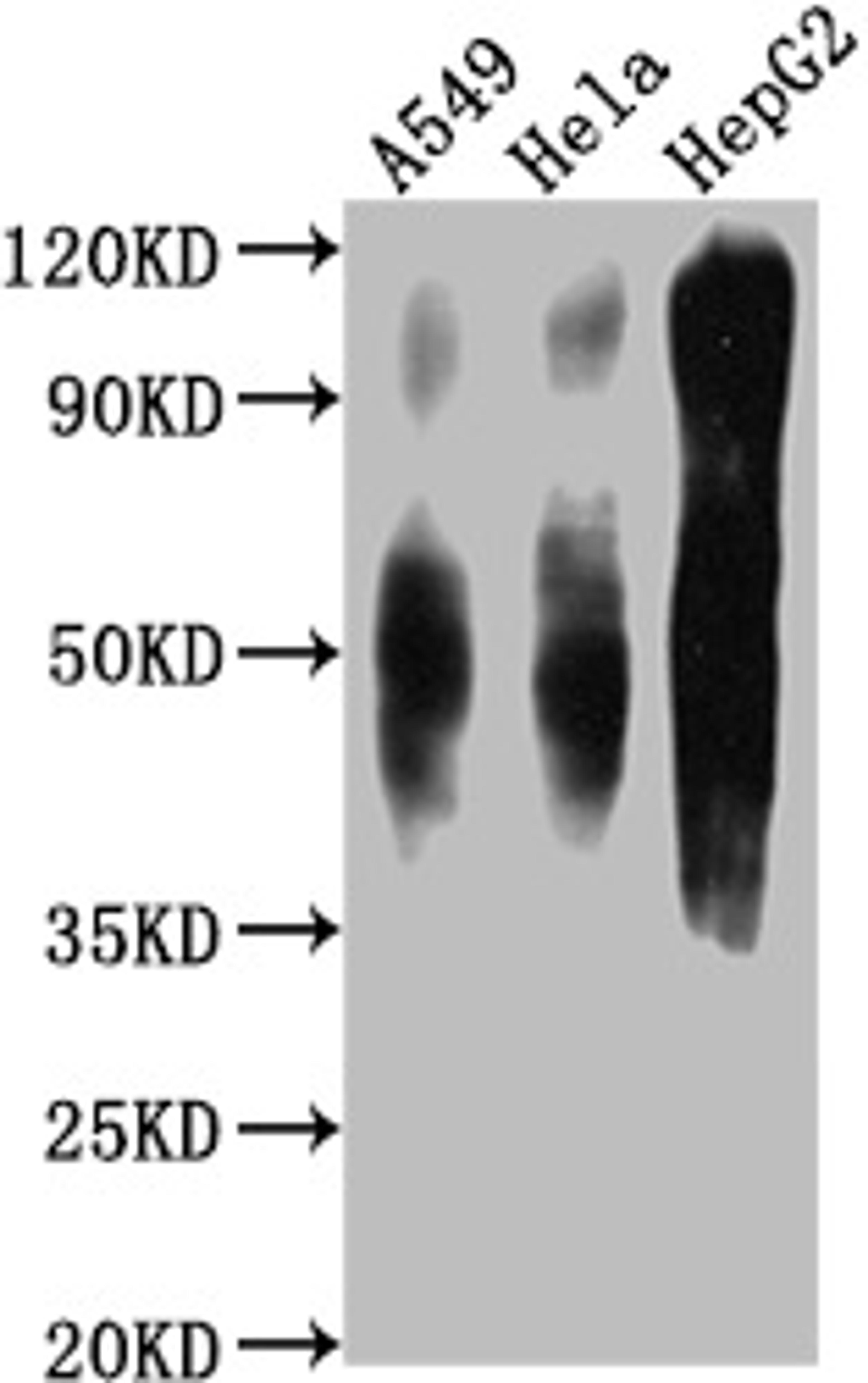 Western Blot. Positive WB detected in: A549 whole cell lysate, Hela whole cell lysate, HepG2 whole cell lysate . All lanes CD63 antibody at 1:1000. Secondary. Goat polyclonal to mouse IgG at 1/50000 dilution. Predicted band size: 30-120 KD KDa. Observed band size: 30-120 KD KDa. Exposure time:1min