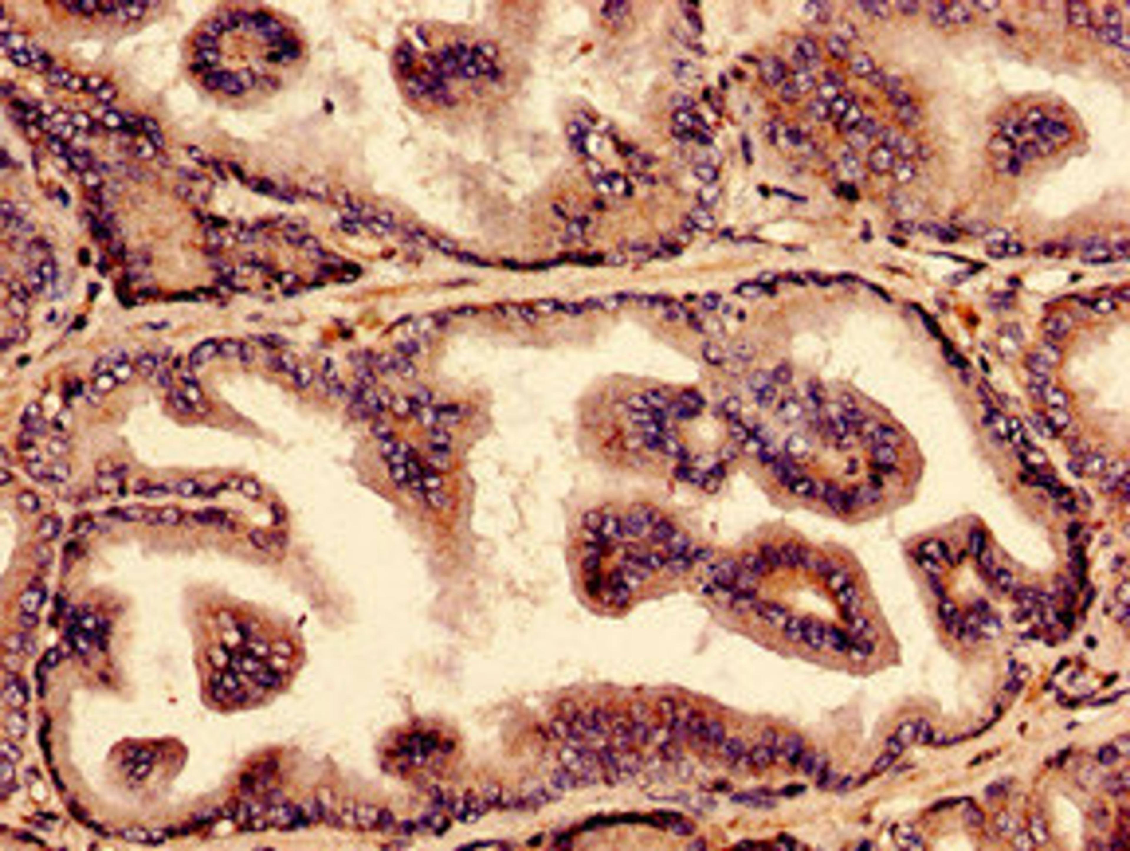 Immunocytochemistry analysis of human prostate tissue using CSB-PA016195LA01HU at dilution of 1:100