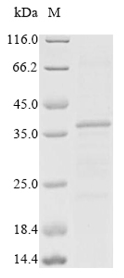 (Tris-Glycine gel) Discontinuous SDS-PAGE (reduced) with 5% enrichment gel and 15% separation gel.