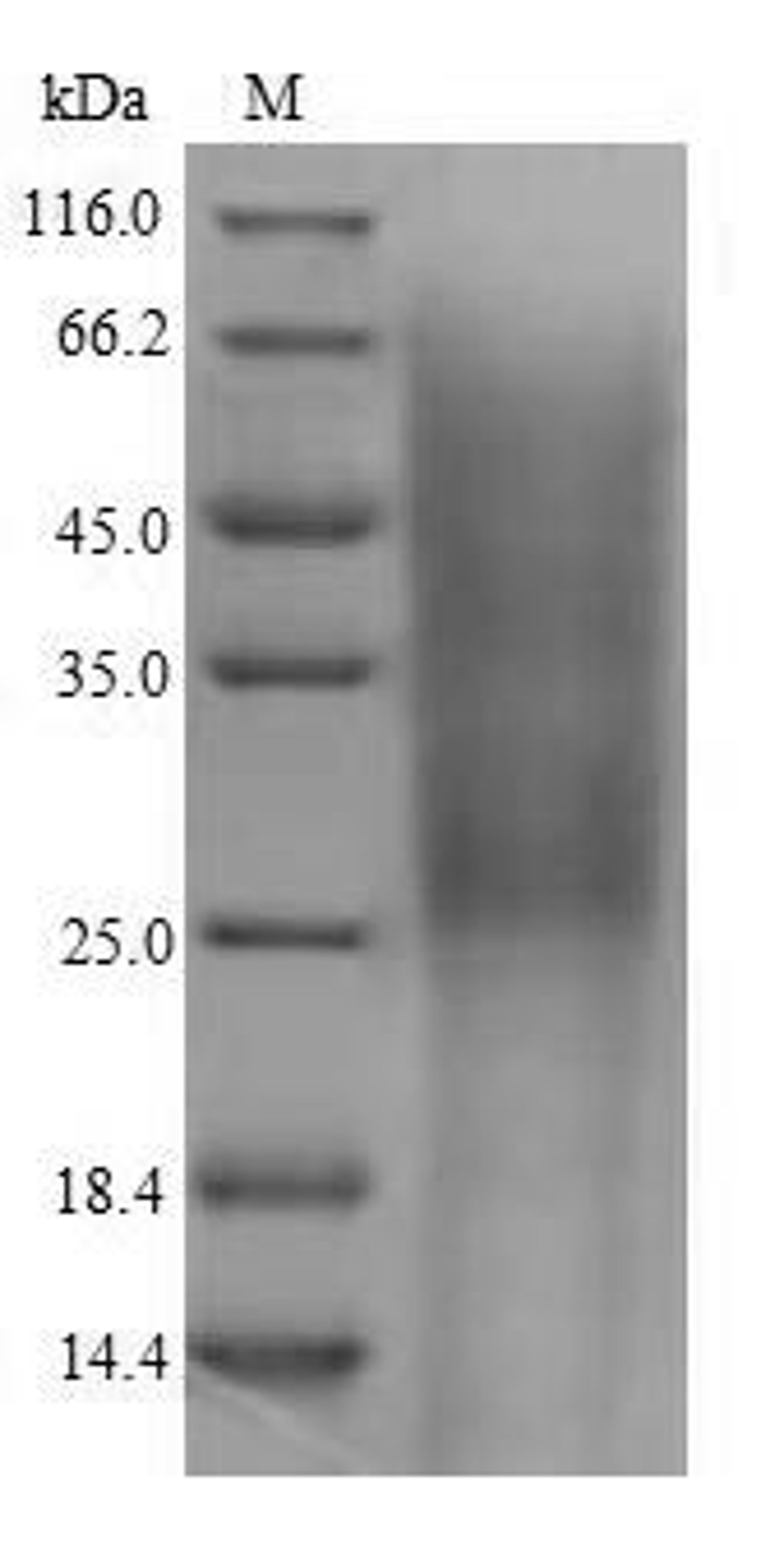 (Tris-Glycine gel) Discontinuous SDS-PAGE (reduced) with 5% enrichment gel and 15% separation gel.