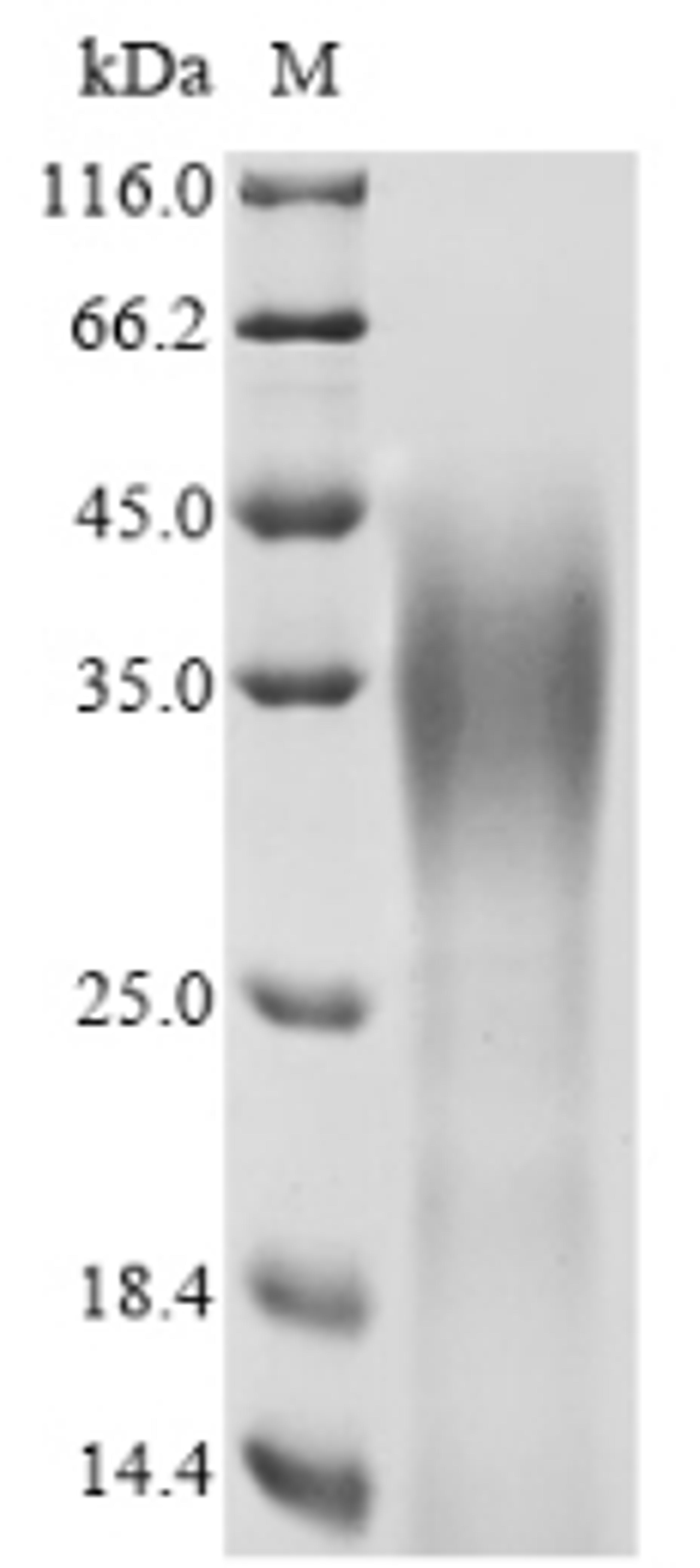 (Tris-Glycine gel) Discontinuous SDS-PAGE (reduced) with 5% enrichment gel and 15% separation gel.