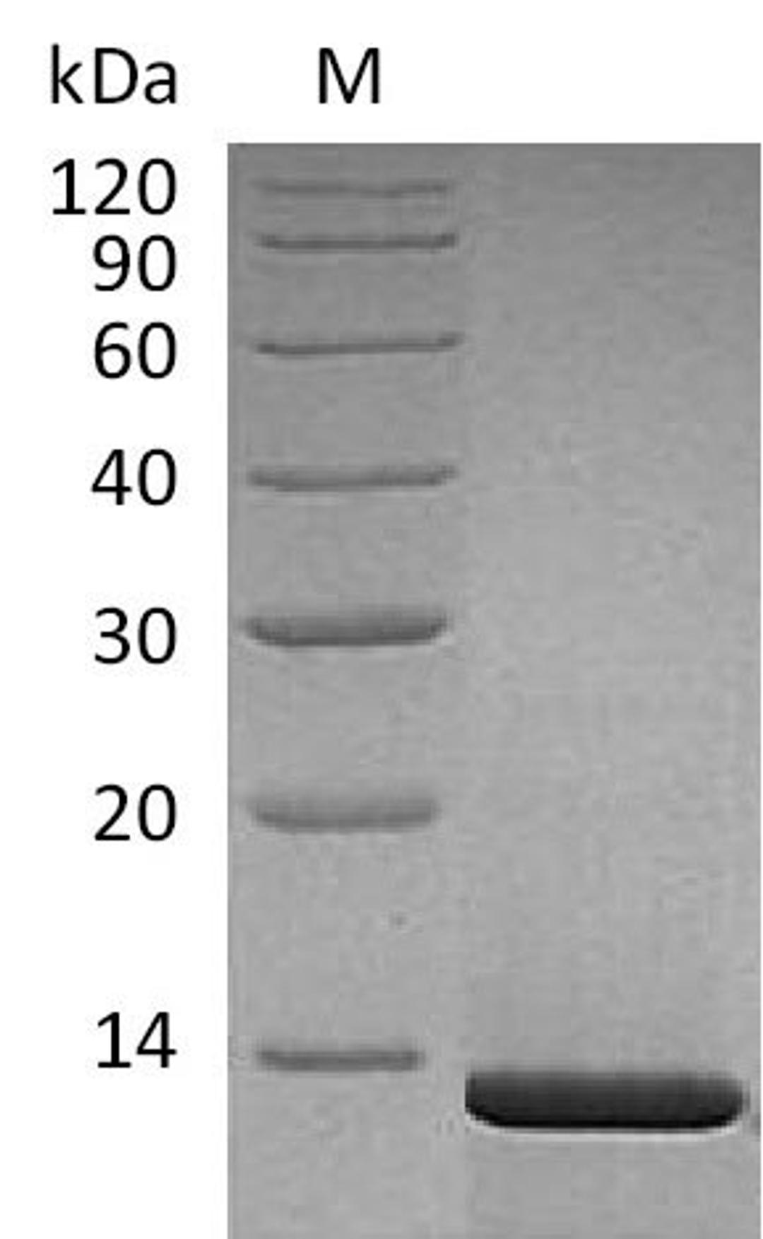 (Tris-Glycine gel) Discontinuous SDS-PAGE (reduced) with 5% enrichment gel and 15% separation gel.