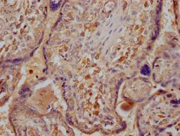 IHC image of CSB-PA892478LA01HU diluted at 1:300 and staining in paraffin-embedded human placenta tissue performed on a Leica BondTM system. After dewaxing and hydration, antigen retrieval was mediated by high pressure in a citrate buffer (pH 6.0). Section was blocked with 10% normal goat serum 30min at RT. Then primary antibody (1% BSA) was incubated at 4°C overnight. The primary is detected by a Goat anti-rabbit IgG labeled by HRP and visualized using 0.05% DAB.