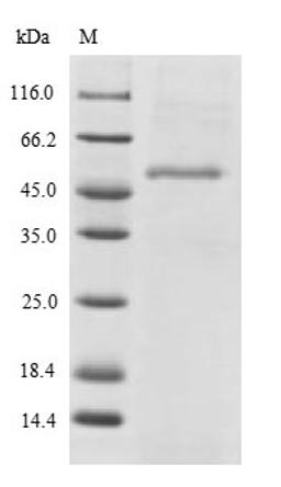 (Tris-Glycine gel) Discontinuous SDS-PAGE (reduced) with 5% enrichment gel and 15% separation gel.