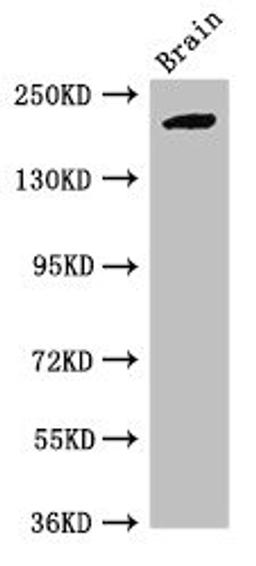 Western Blot. Positive WB detected in: Mouse brain tissue. All lanes: RBBP6 antibody at 2.7ug/ml. Secondary. Goat polyclonal to rabbit IgG at 1/50000 dilution. Predicted band size: 202, 198, 14, 107 kDa. Observed band size: 202 kDa. 