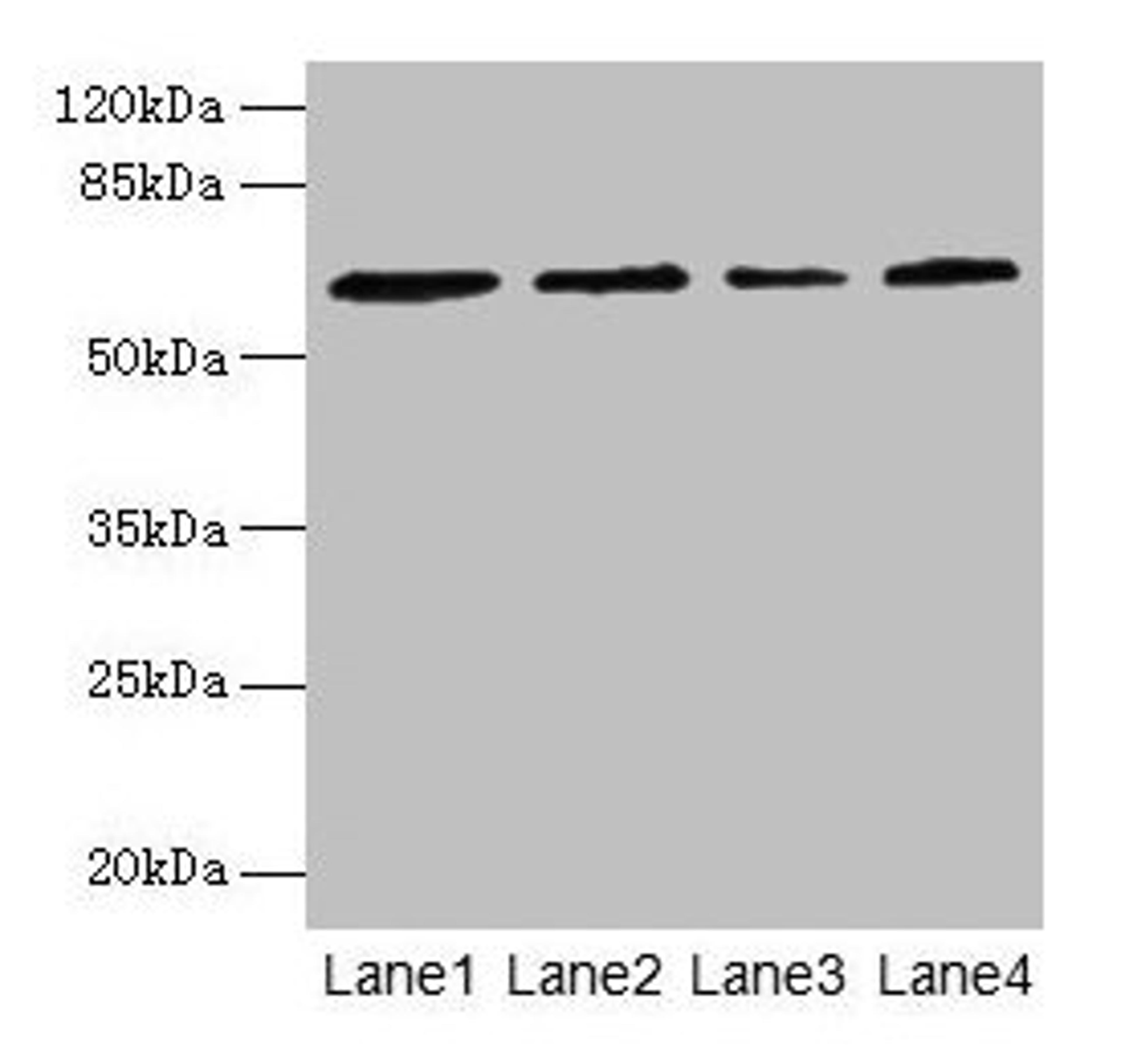 Western blot. All lanes: CSGALNACT2 antibody at 4µg/ml. Lane 1: K562 whole cell lysate. Lane 2: 293T whole cell lysate. Lane 3: Jurkat whole cell lysate. Lane 4: PC-3 whole cell lysate. Secondary. Goat polyclonal to rabbit IgG at 1/10000 dilution. Predicted band size: 63, 39 kDa. Observed band size: 63 kDa