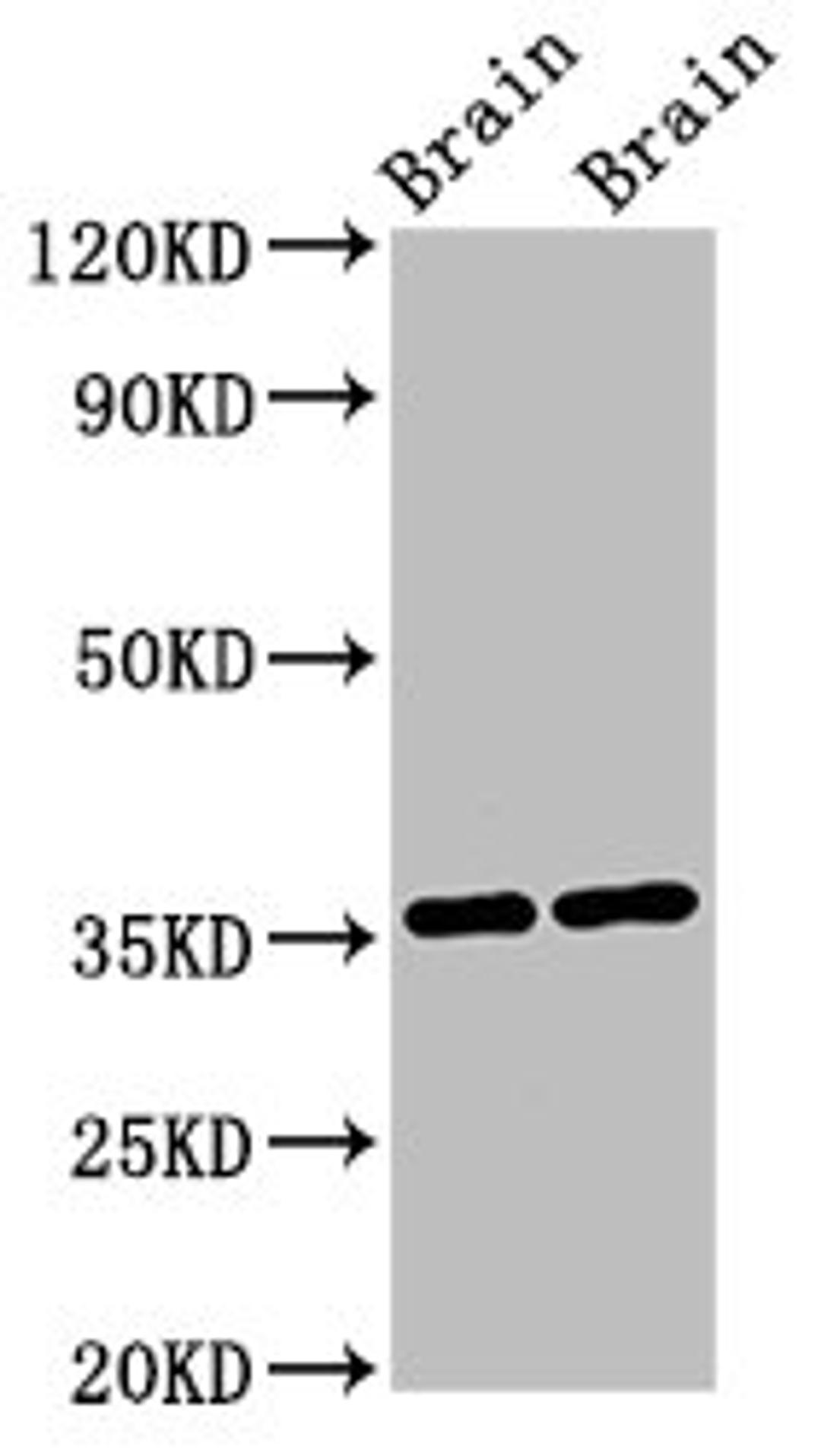 Western Blot. Positive WB detected in: Mouse brain tissue, Rat brain tissue. All lanes: NIT1 antibody at 3µg/ml. Secondary. Goat polyclonal to rabbit IgG at 1/50000 dilution. Predicted band size: 36, 32, 41, 35, 27 kDa. Observed band size: 36 kDa