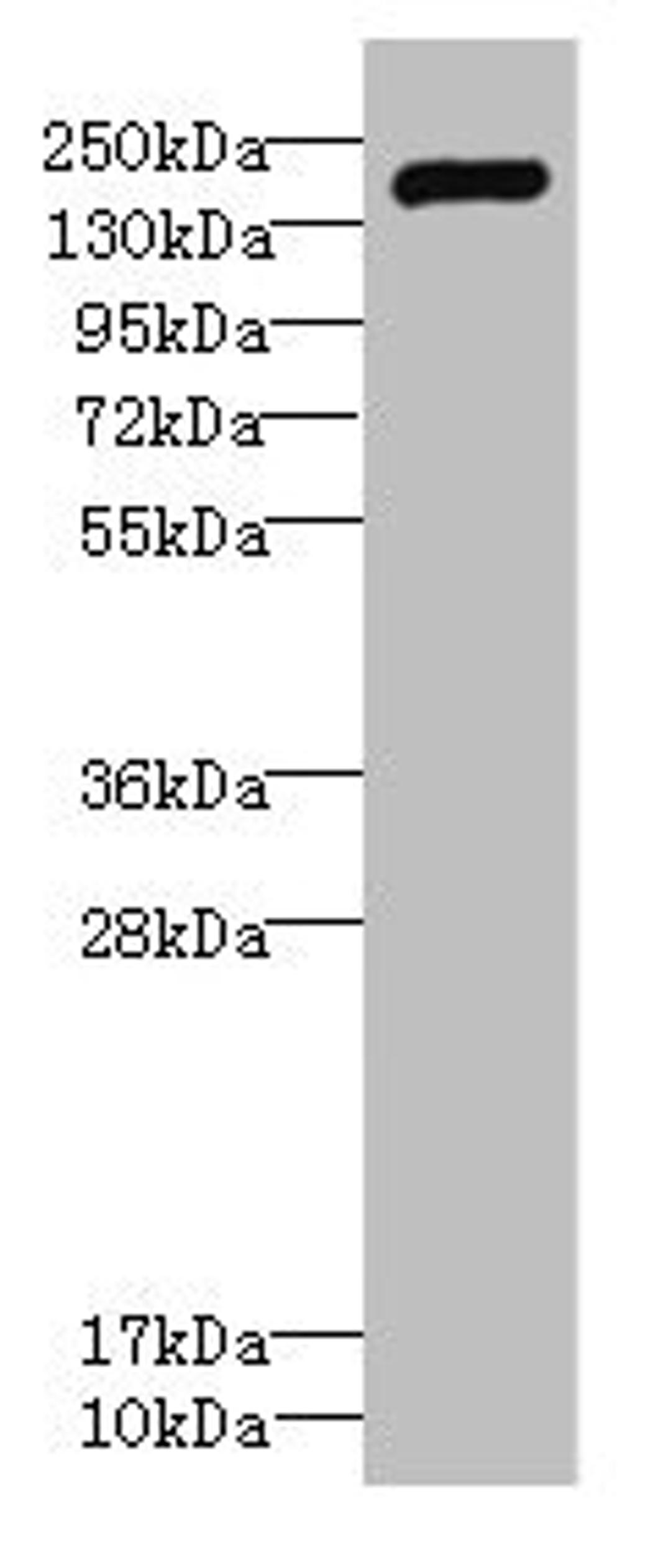 Western blot. All lanes: VARS antibody IgG at 2.29ug/ml + Hela whole cell lysate. Secondary. Goat polyclonal to rabbit IgG at 1/10000 dilution. Predicted band size: 141, 34 kDa. Observed band size: 141 kDa. 