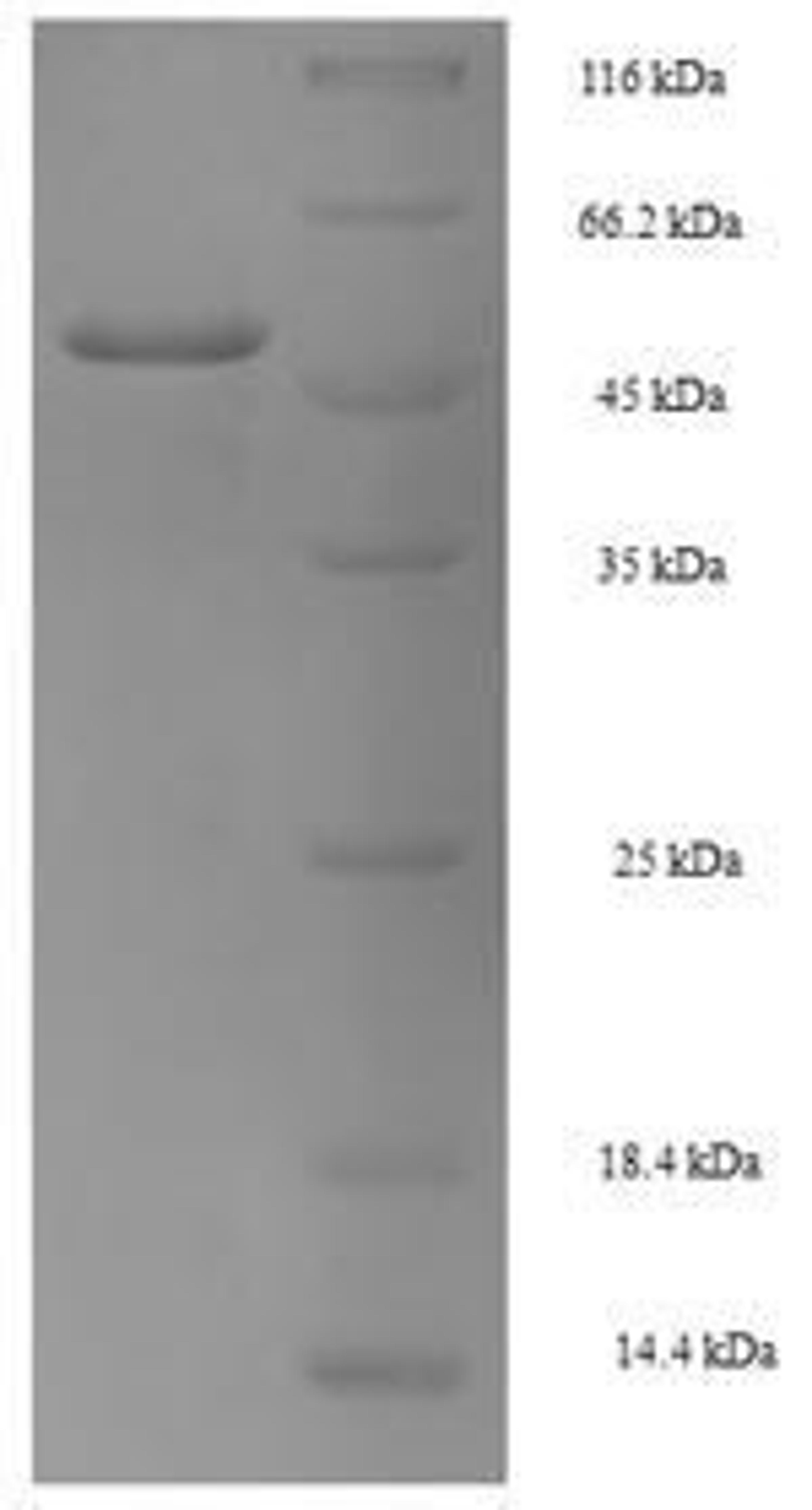 (Tris-Glycine gel) Discontinuous SDS-PAGE (reduced) with 5% enrichment gel and 15% separation gel.