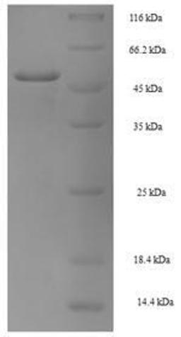 (Tris-Glycine gel) Discontinuous SDS-PAGE (reduced) with 5% enrichment gel and 15% separation gel.