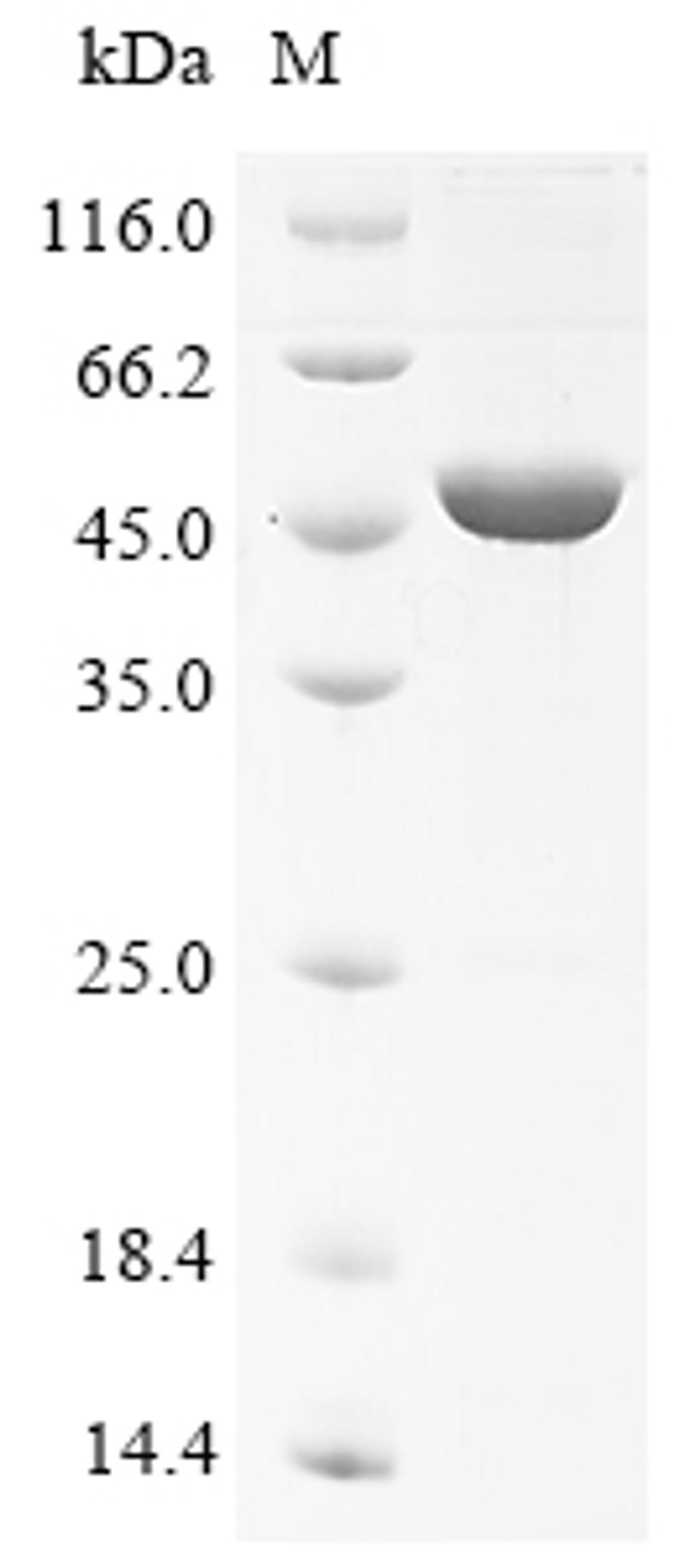 (Tris-Glycine gel) Discontinuous SDS-PAGE (reduced) with 5% enrichment gel and 15% separation gel.