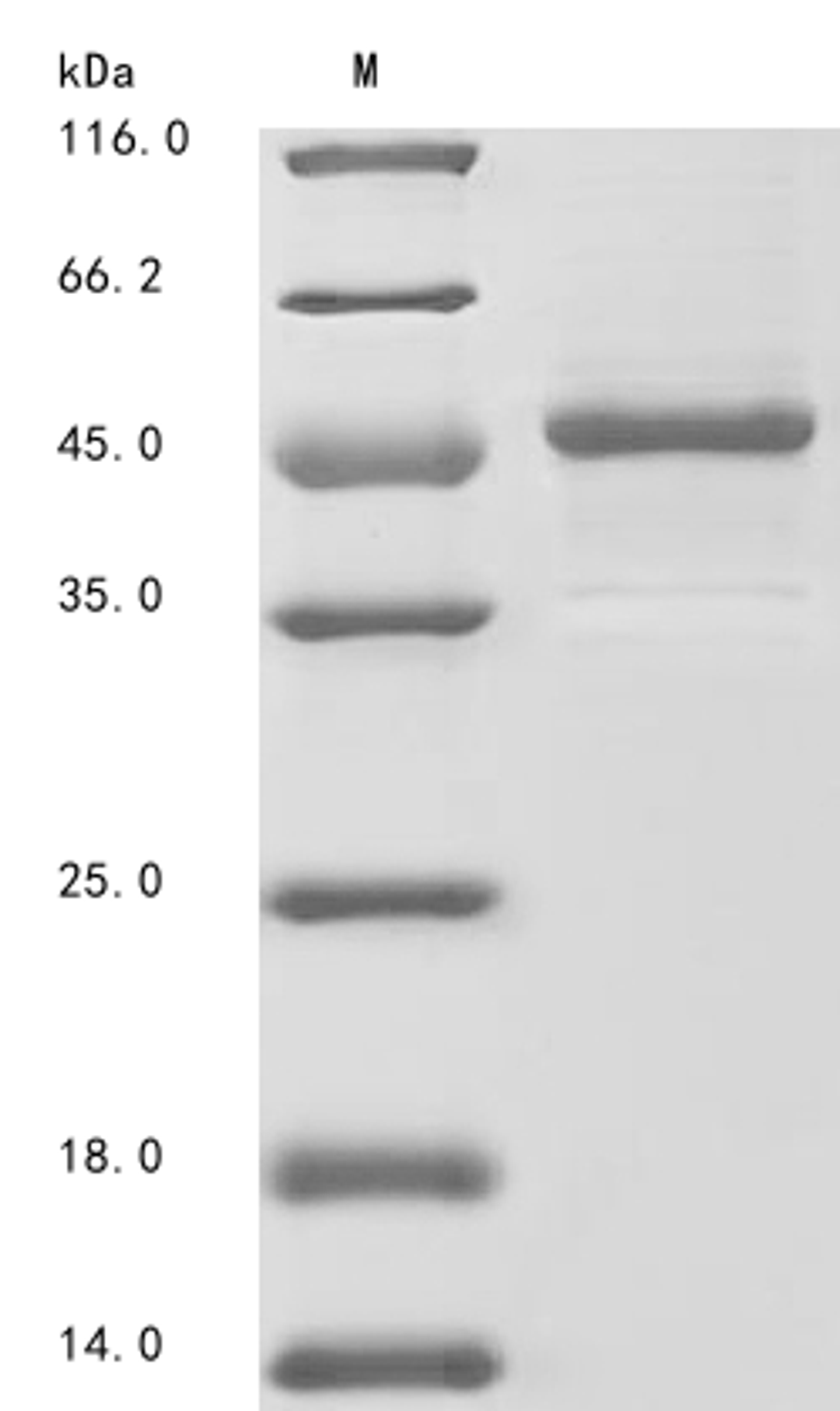 (Tris-Glycine gel) Discontinuous SDS-PAGE (reduced) with 5% enrichment gel and 15% separation gel.