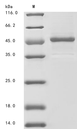(Tris-Glycine gel) Discontinuous SDS-PAGE (reduced) with 5% enrichment gel and 15% separation gel.