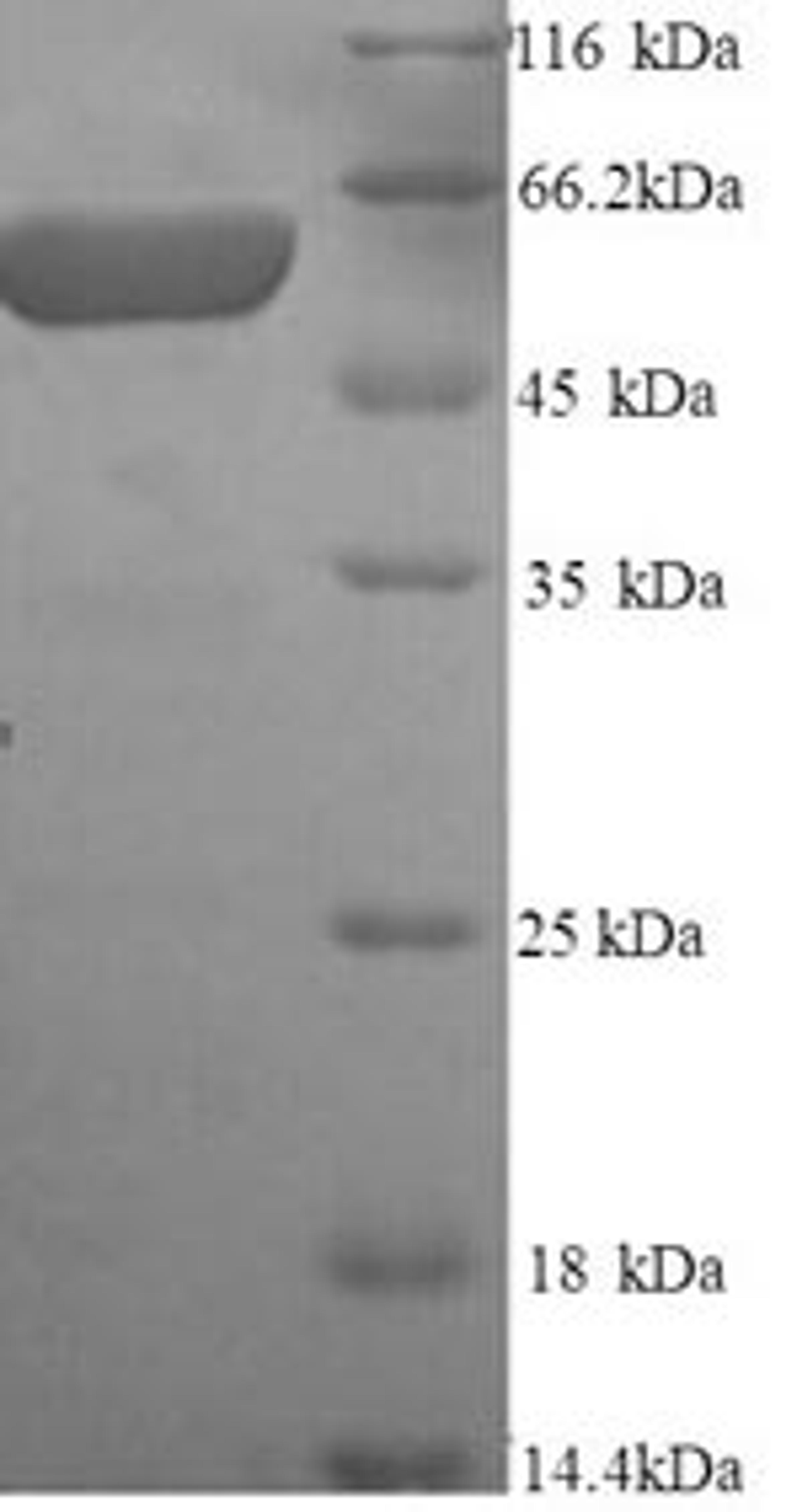 (Tris-Glycine gel) Discontinuous SDS-PAGE (reduced) with 5% enrichment gel and 15% separation gel.