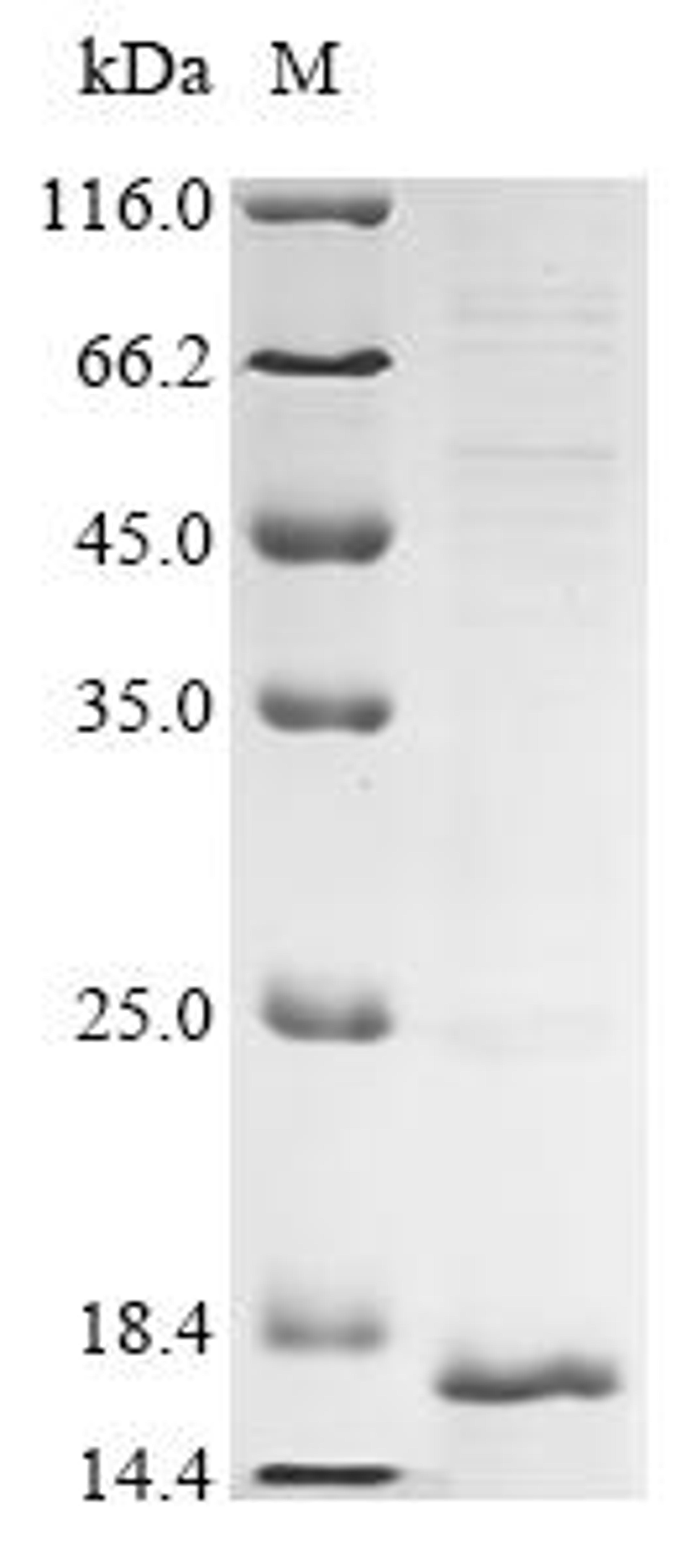 (Tris-Glycine gel) Discontinuous SDS-PAGE (reduced) with 5% enrichment gel and 15% separation gel.