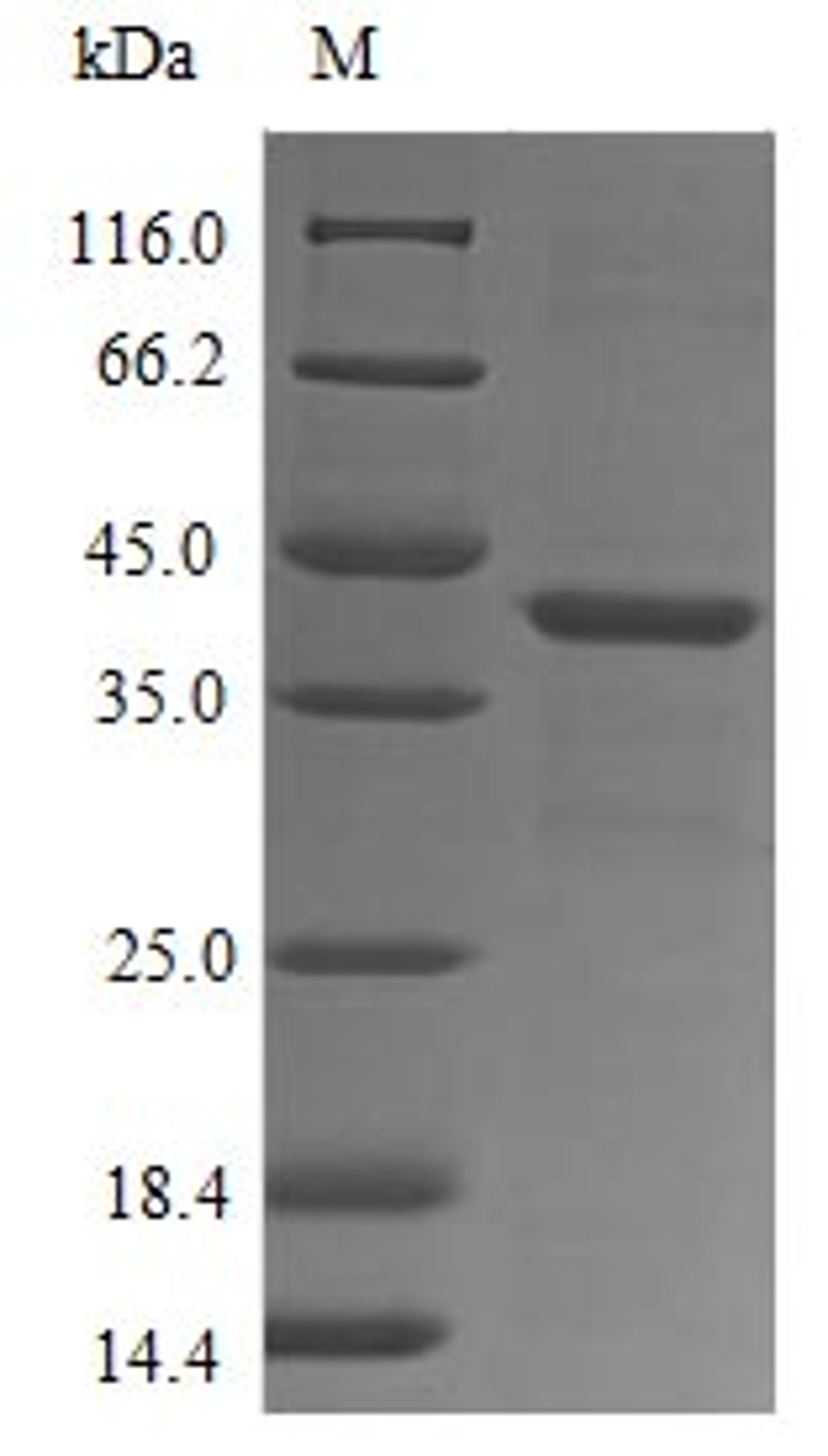 (Tris-Glycine gel) Discontinuous SDS-PAGE (reduced) with 5% enrichment gel and 15% separation gel.