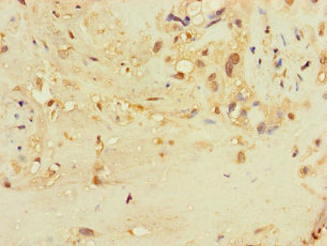 Immunohistochemistry of paraffin-embedded human placenta tissue using CSB-PA842746LA01HU at dilution of 1:100