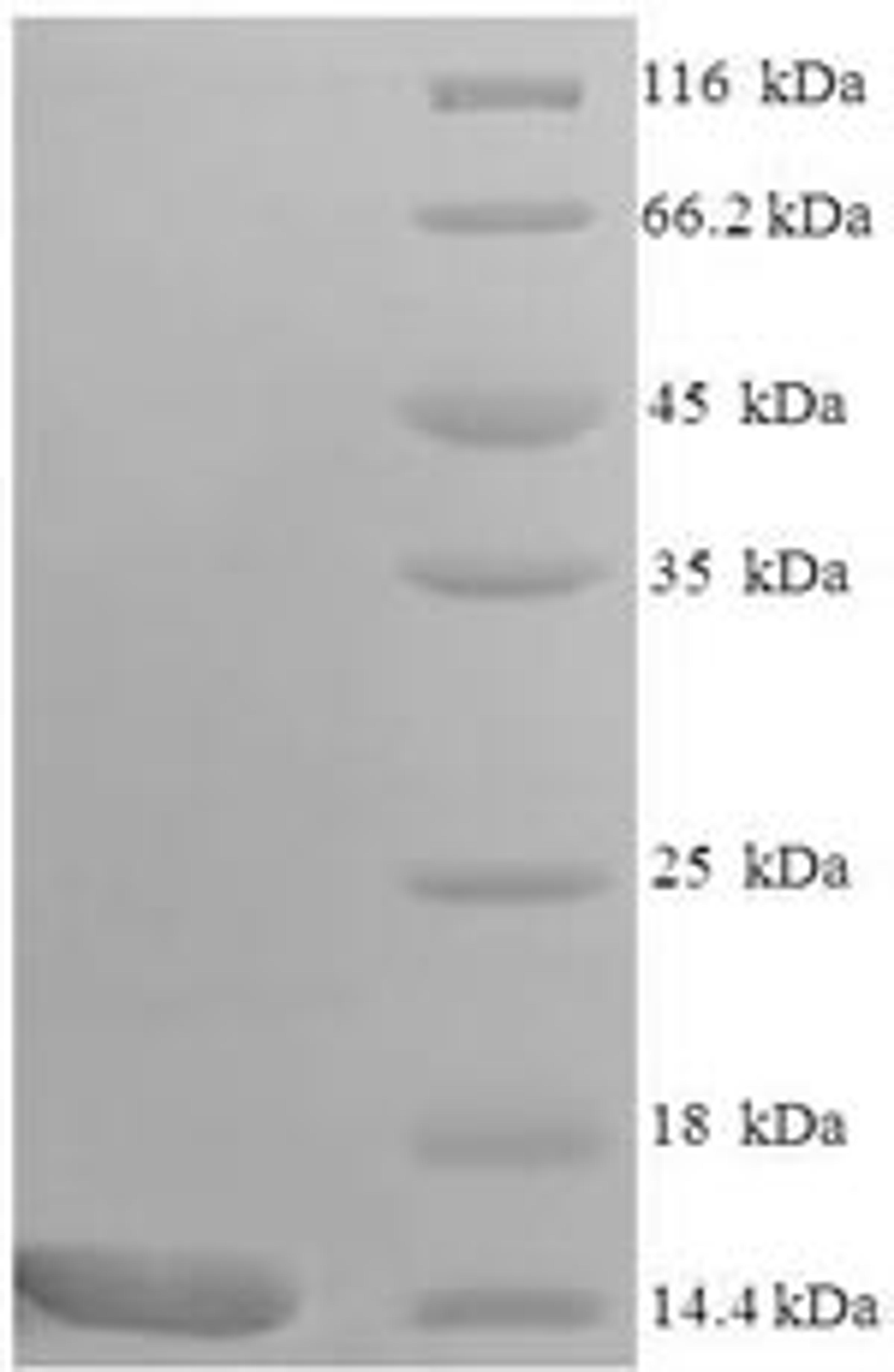 (Tris-Glycine gel) Discontinuous SDS-PAGE (reduced) with 5% enrichment gel and 15% separation gel.