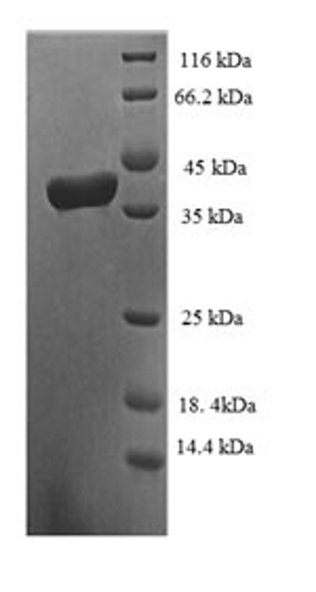 (Tris-Glycine gel) Discontinuous SDS-PAGE (reduced) with 5% enrichment gel and 15% separation gel.