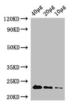 Western Blot. Positive WB detected in: Rosseta bacteria lysate at 40µg, 20µg, 10µg. All lanes: rpiA antibody at 1µg/ml. Secondary. Goat polyclonal to rabbit IgG at 1/50000 dilution. Predicted band size: 23 kDa. Observed band size: 23 kDa