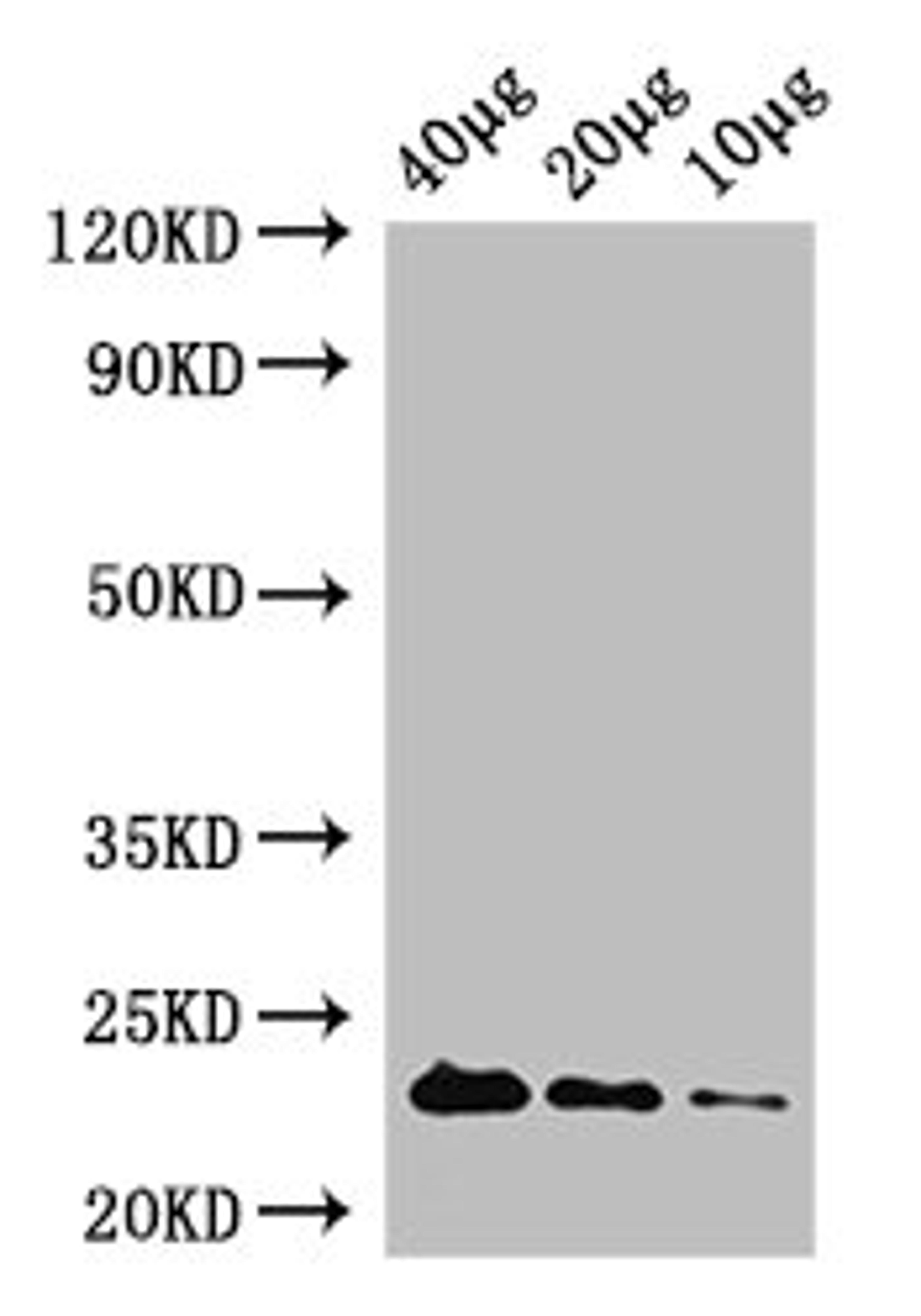 Western Blot. Positive WB detected in: Rosseta bacteria lysate at 40µg, 20µg, 10µg. All lanes: rpiA antibody at 1µg/ml. Secondary. Goat polyclonal to rabbit IgG at 1/50000 dilution. Predicted band size: 23 kDa. Observed band size: 23 kDa