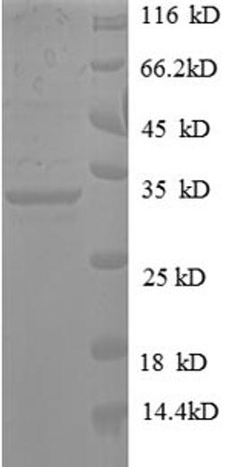 (Tris-Glycine gel) Discontinuous SDS-PAGE (reduced) with 5% enrichment gel and 15% separation gel.