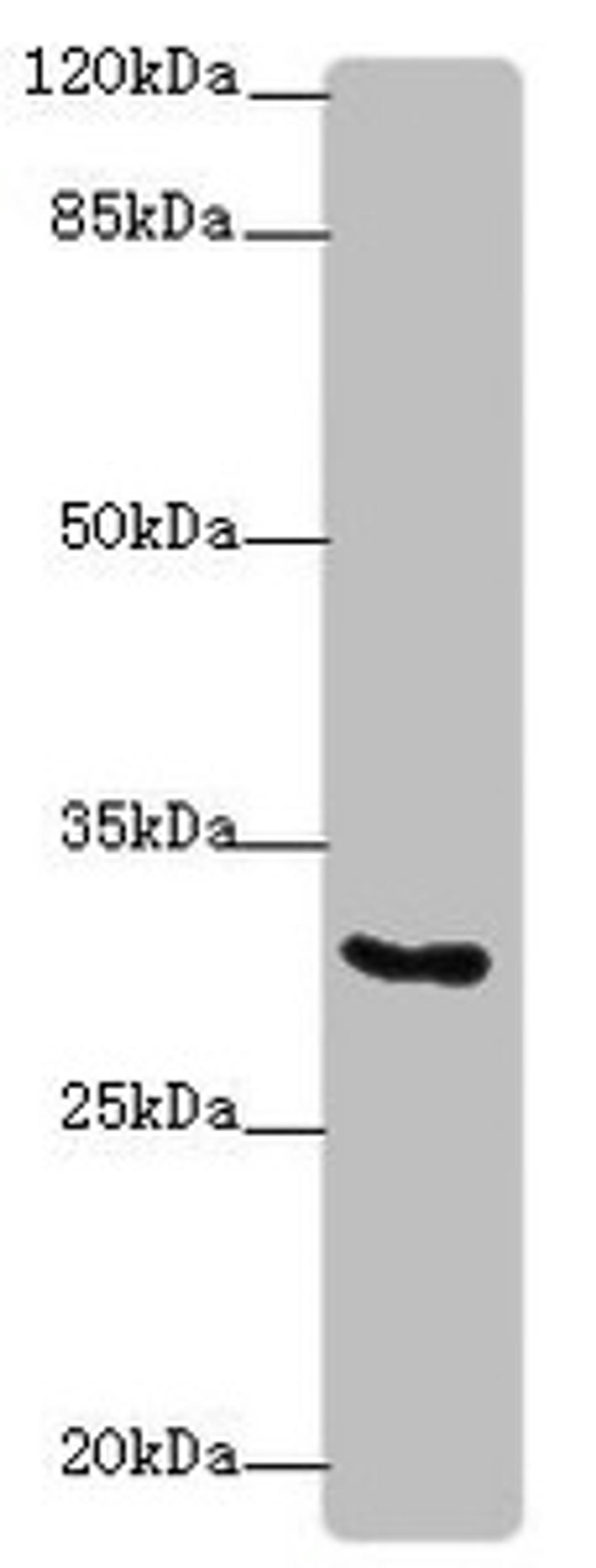 Western blot. All lanes: KCNIP2antibody at 4.58ug/ml + Hela whole cell lysate. Secondary. Goat polyclonal to rabbit IgG at 1/10000 dilution. Predicted band size: 31, 29, 26, 27, 33, 21, 22 kDa. Observed band size: 31 kDa. 