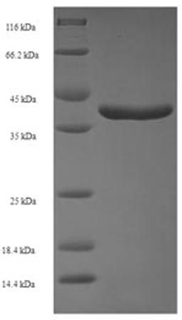 (Tris-Glycine gel) Discontinuous SDS-PAGE (reduced) with 5% enrichment gel and 15% separation gel.