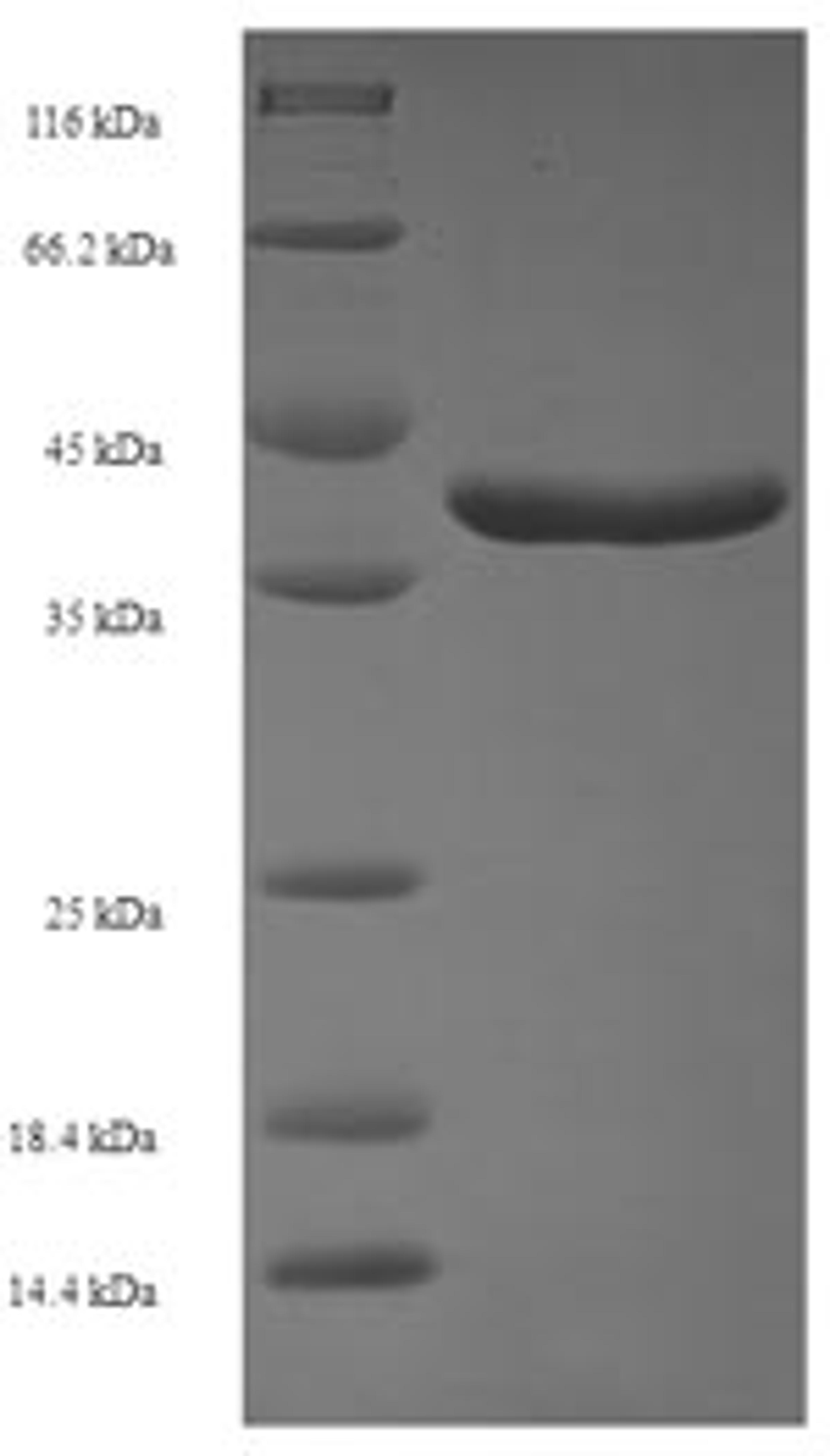 (Tris-Glycine gel) Discontinuous SDS-PAGE (reduced) with 5% enrichment gel and 15% separation gel.