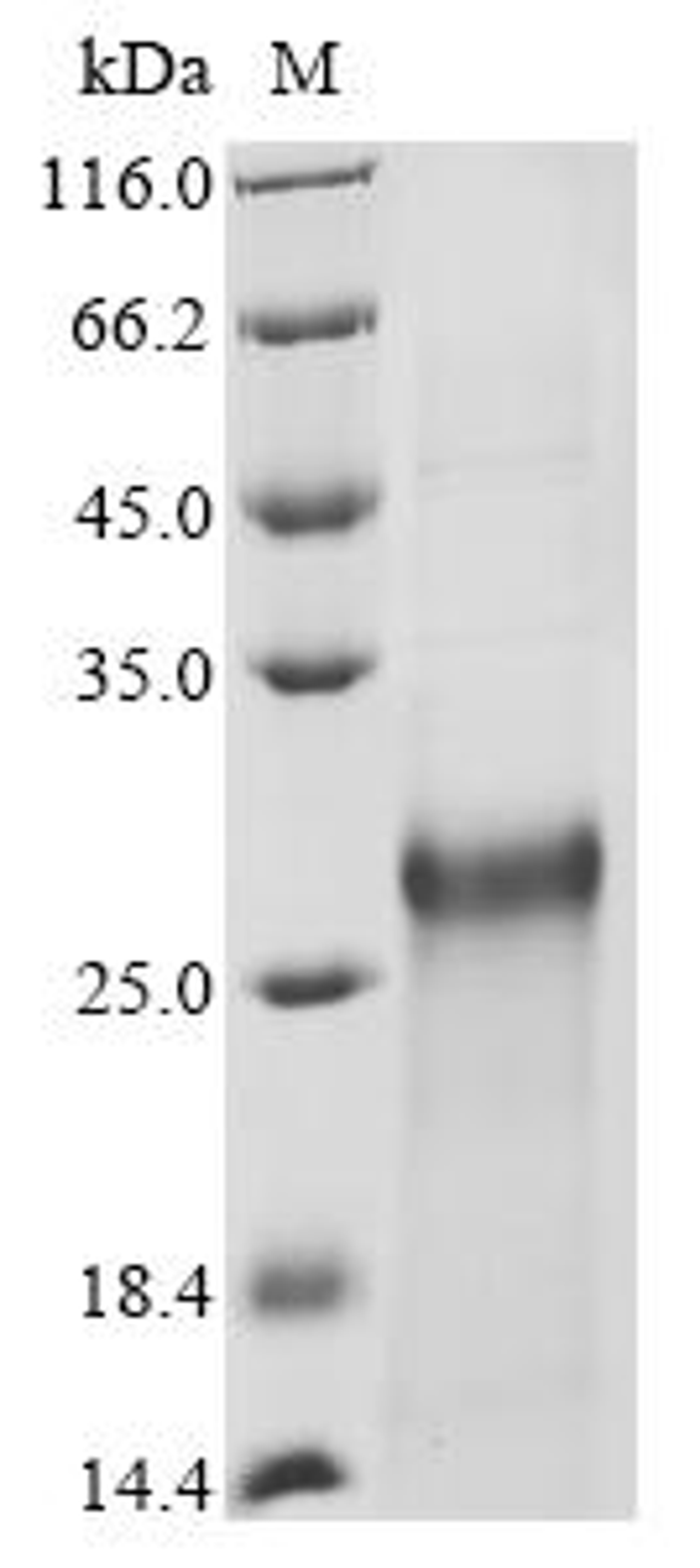 (Tris-Glycine gel) Discontinuous SDS-PAGE (reduced) with 5% enrichment gel and 15% separation gel.