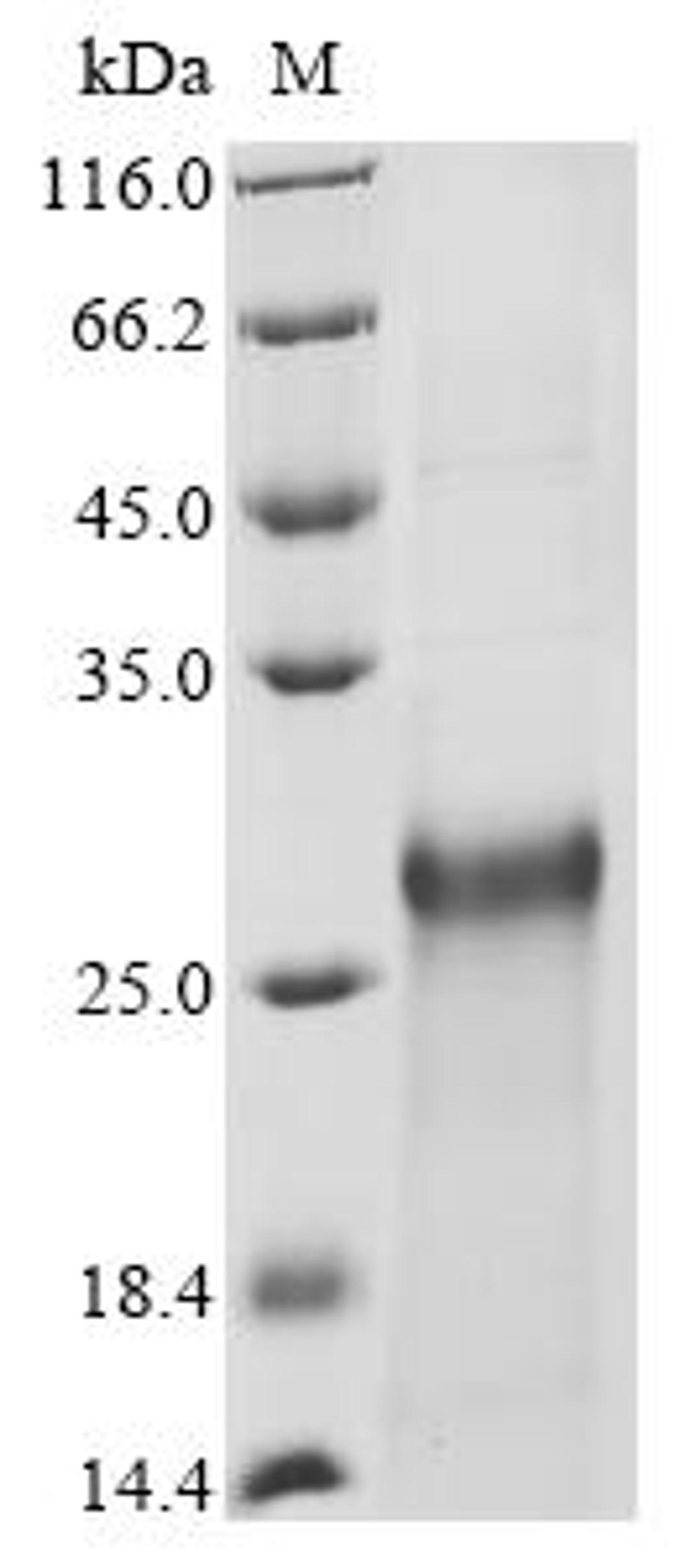 (Tris-Glycine gel) Discontinuous SDS-PAGE (reduced) with 5% enrichment gel and 15% separation gel.