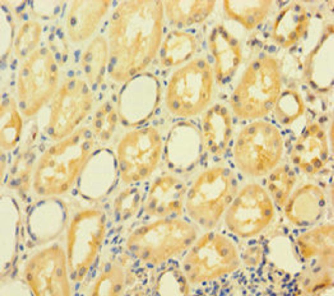 Immunohistochemistry of paraffin-embedded human kidney tissue using CSB-PA750350LA01HU at dilution of 1:100