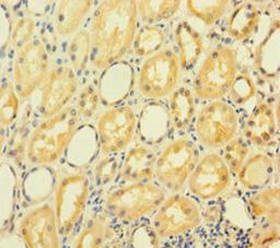 Immunohistochemistry of paraffin-embedded human kidney tissue using CSB-PA750350LA01HU at dilution of 1:100