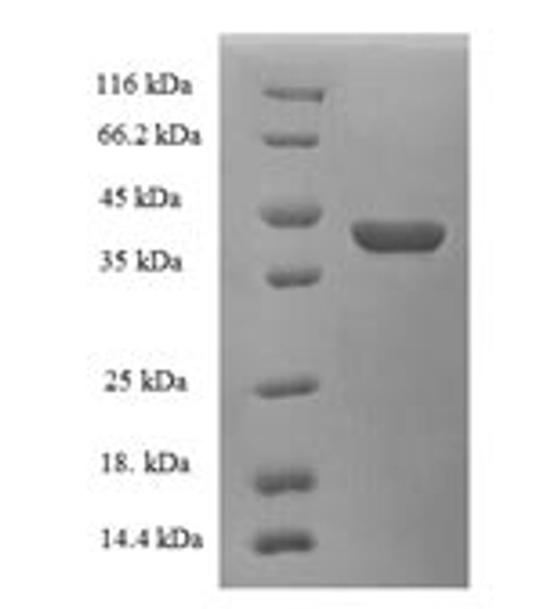 (Tris-Glycine gel) Discontinuous SDS-PAGE (reduced) with 5% enrichment gel and 15% separation gel.