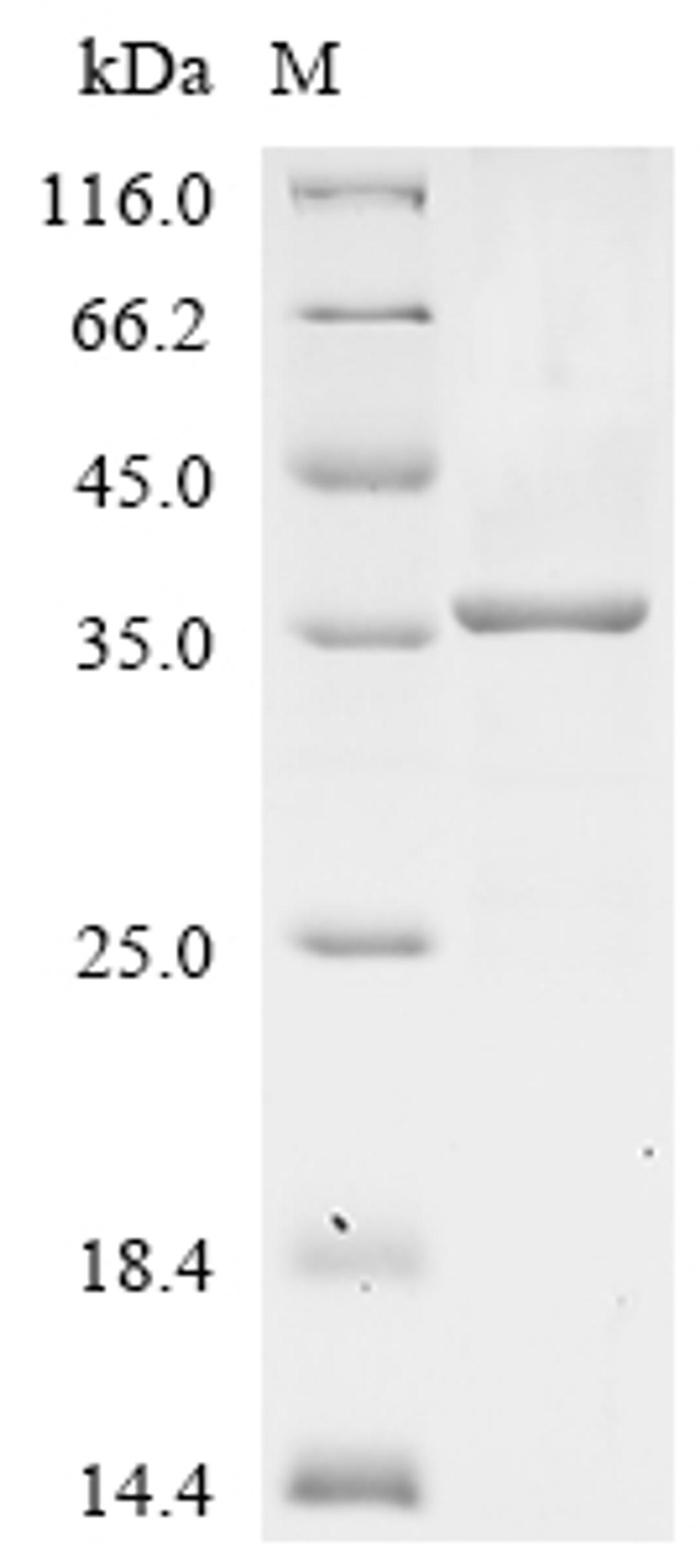 (Tris-Glycine gel) Discontinuous SDS-PAGE (reduced) with 5% enrichment gel and 15% separation gel.